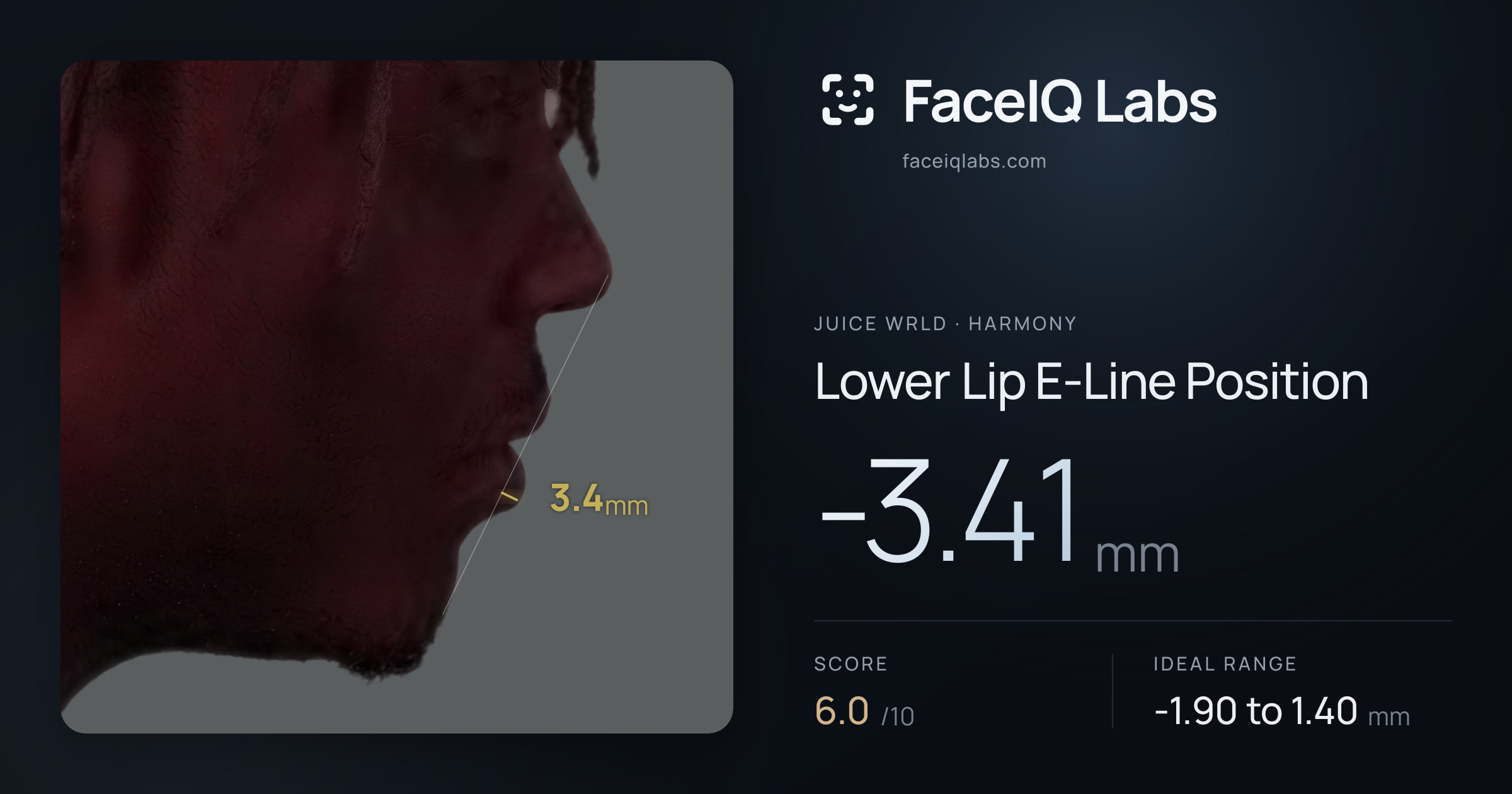 Juice WRLD Lower Lip E-Line Position: -3.41mm, drawn on the photo