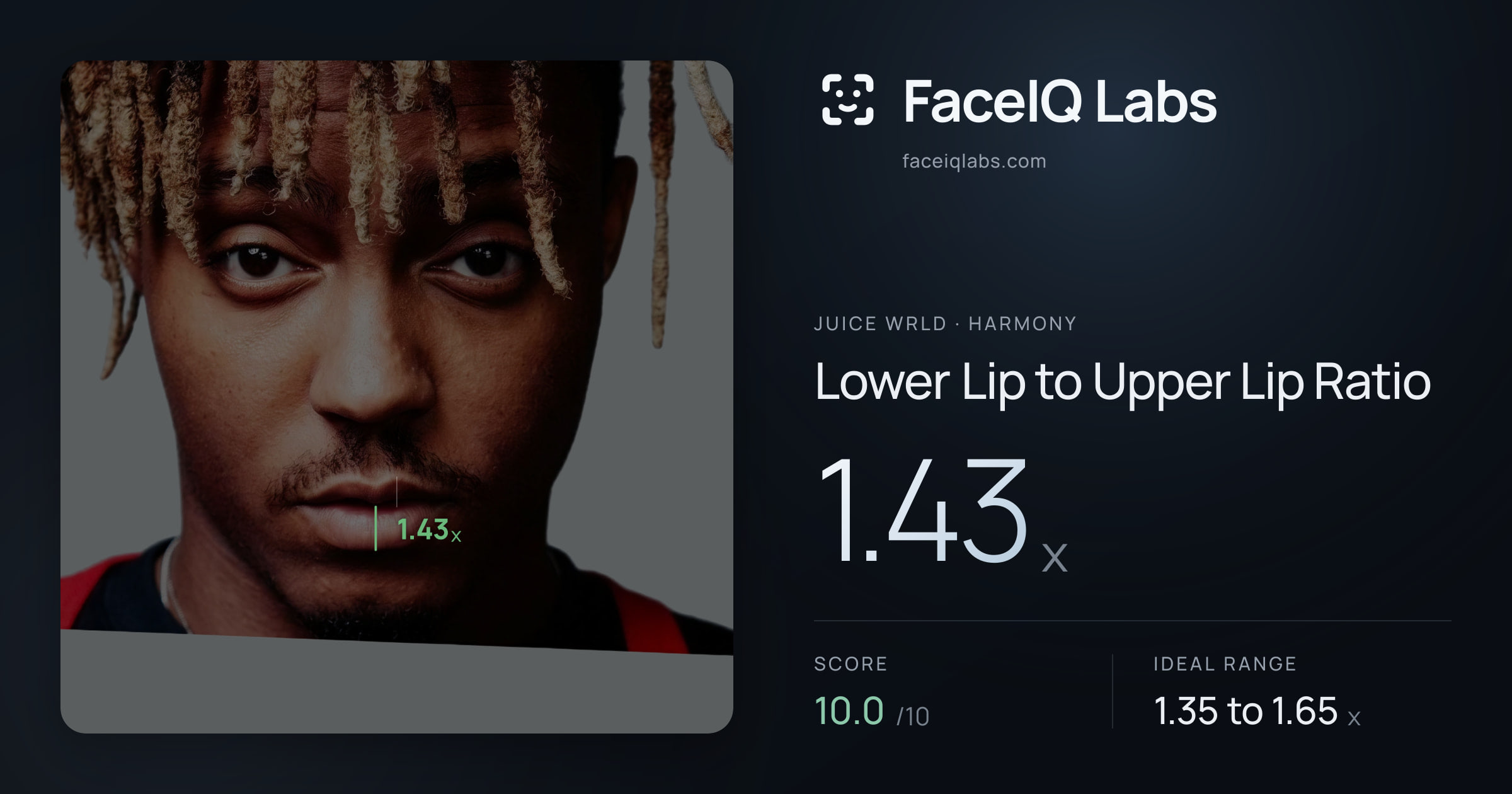 Juice WRLD Lower Lip to Upper Lip Ratio: 1.43x, drawn on the photo