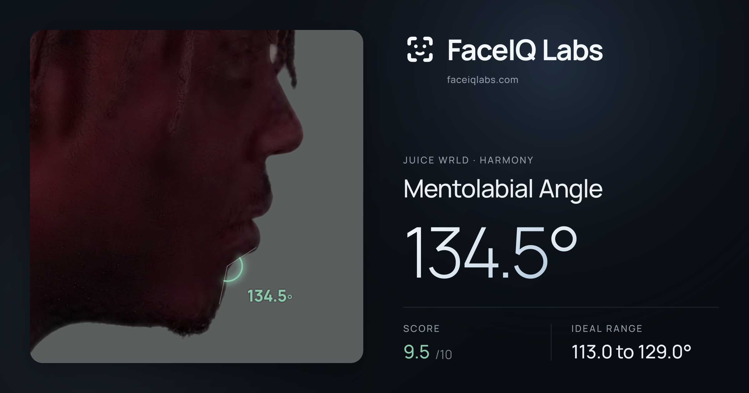 Juice WRLD Mentolabial Angle: 134.5°, drawn on the photo