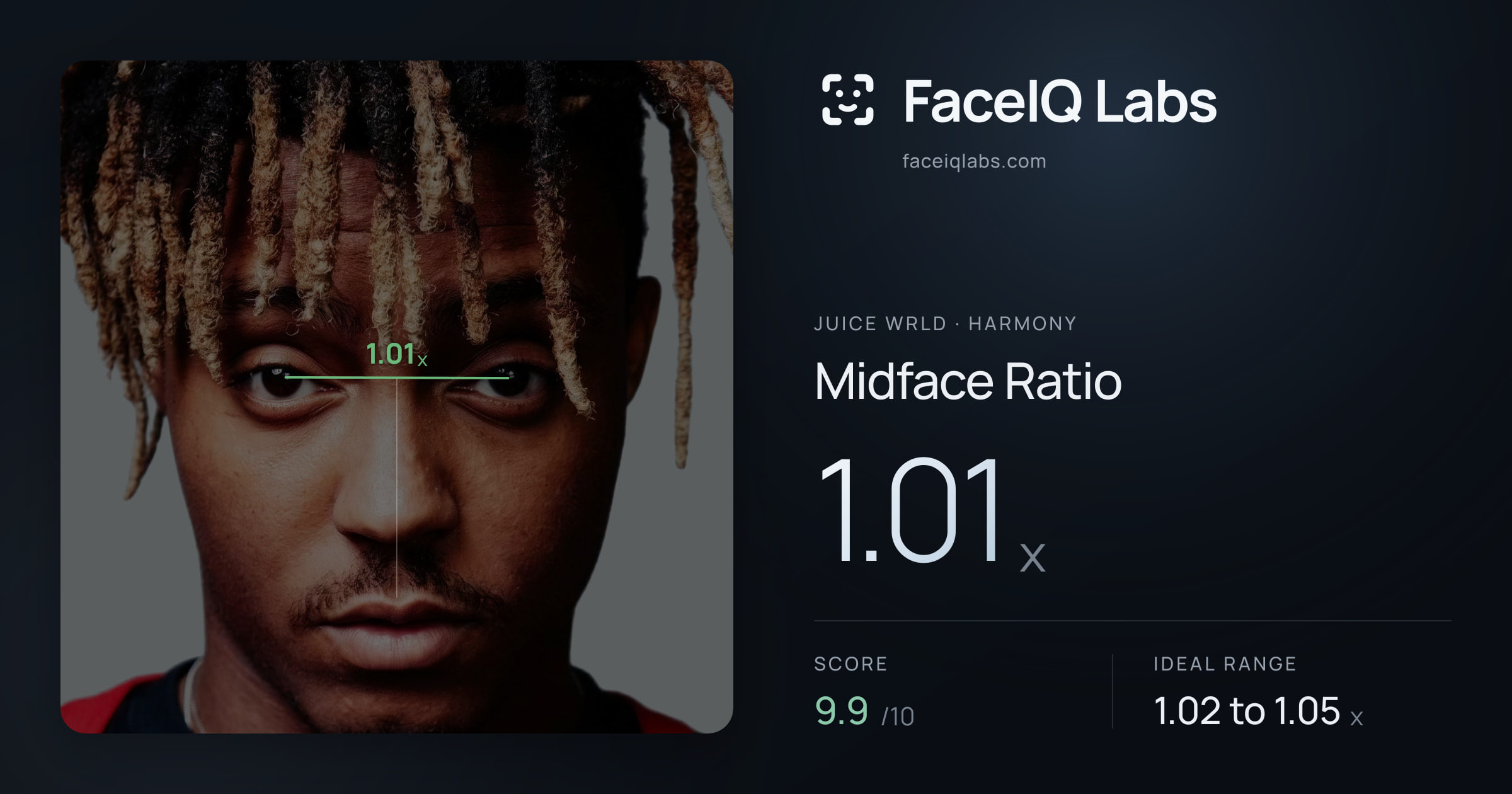 Juice WRLD Midface Ratio: 1.01x, drawn on the photo