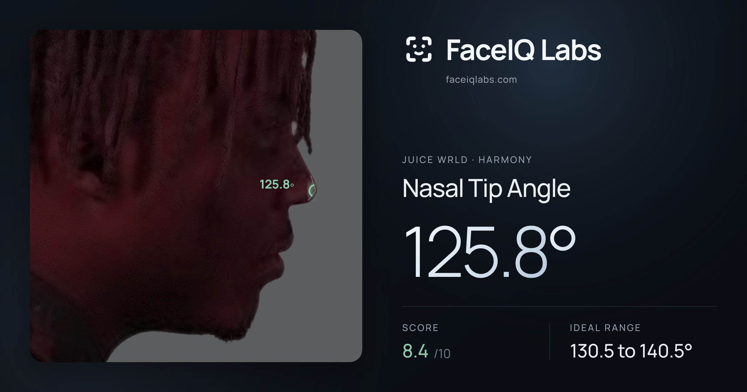Juice WRLD Nasal Tip Angle: 125.8°, drawn on the photo