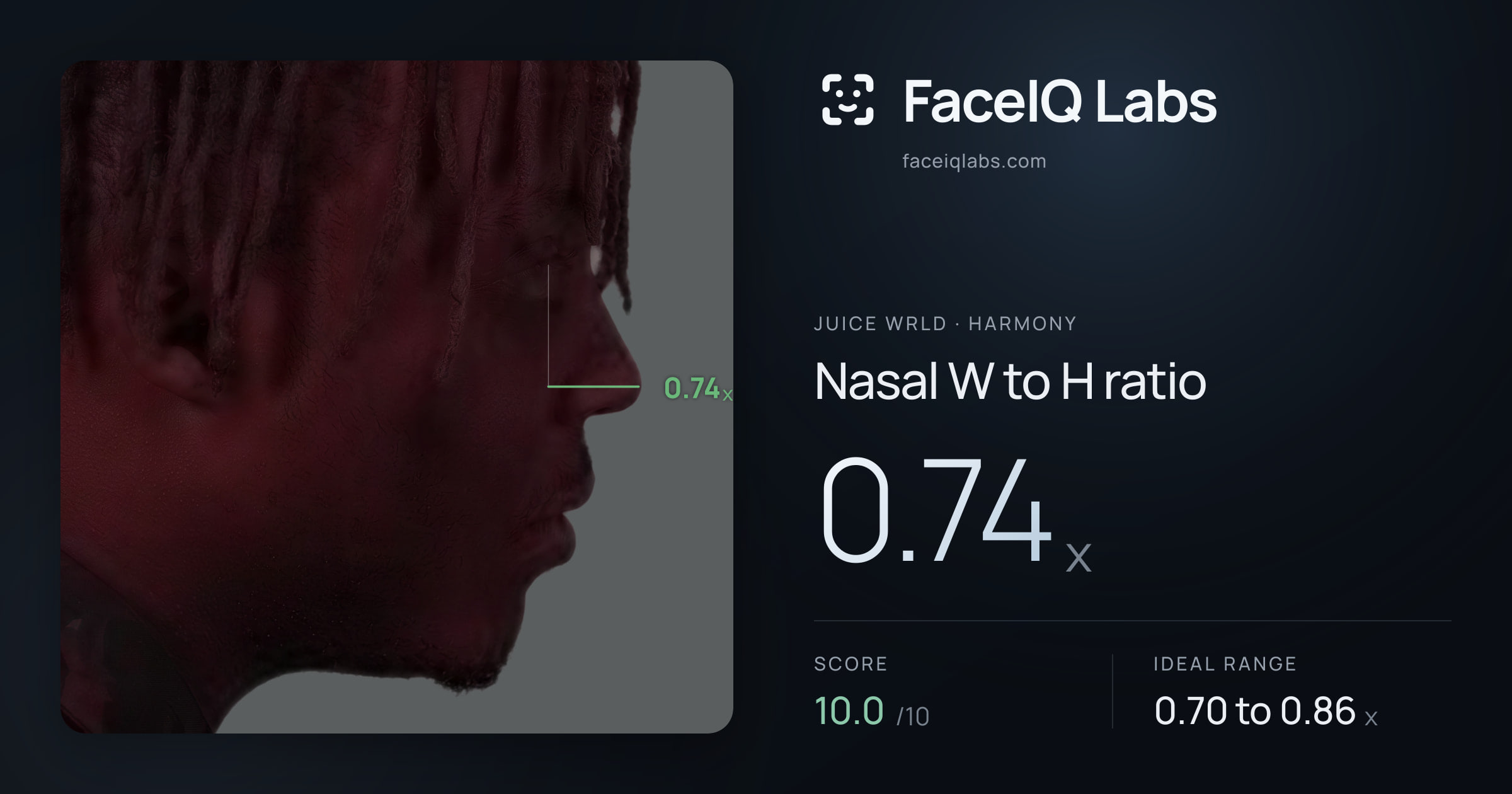 Juice WRLD Nasal W to H ratio: 0.74x, drawn on the photo