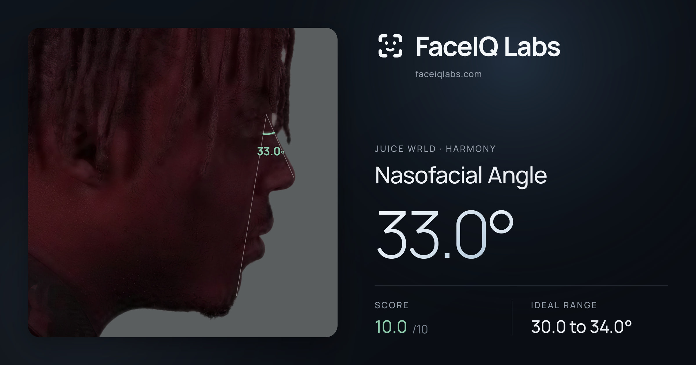 Juice WRLD Nasofacial Angle: 33.0°, drawn on the photo