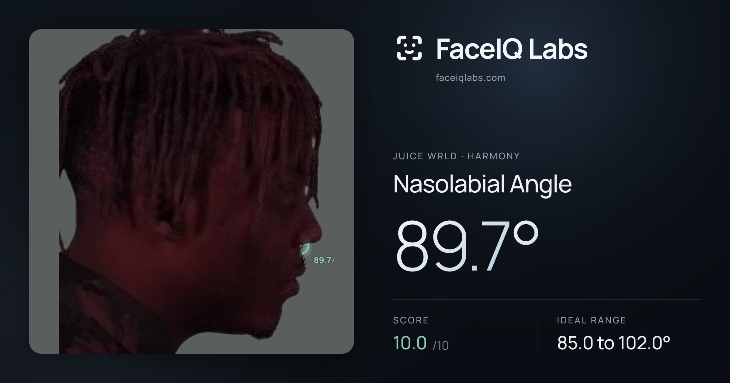 Juice WRLD Nasolabial Angle: 89.7°, drawn on the photo
