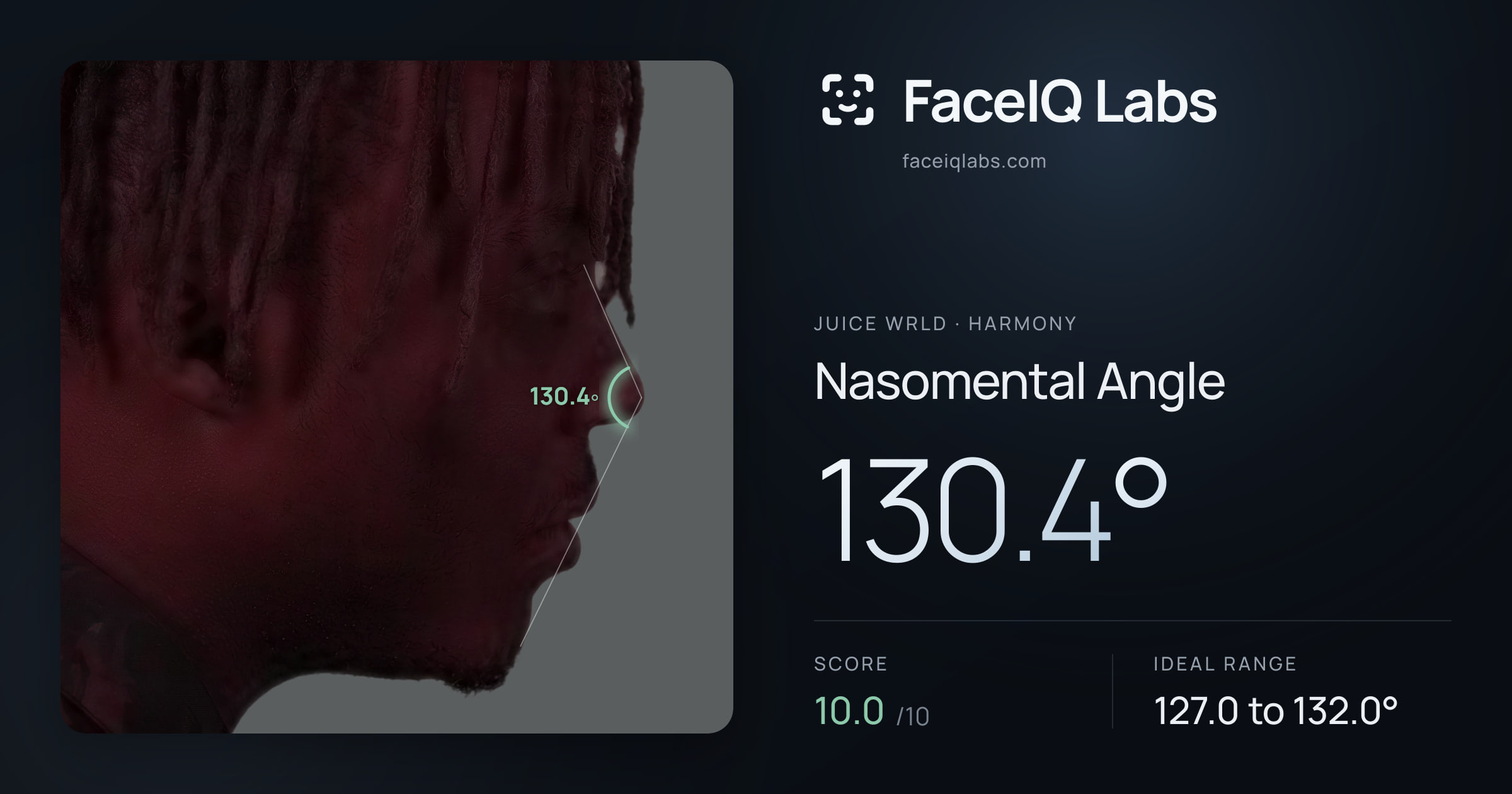 Juice WRLD Nasomental Angle: 130.4°, drawn on the photo