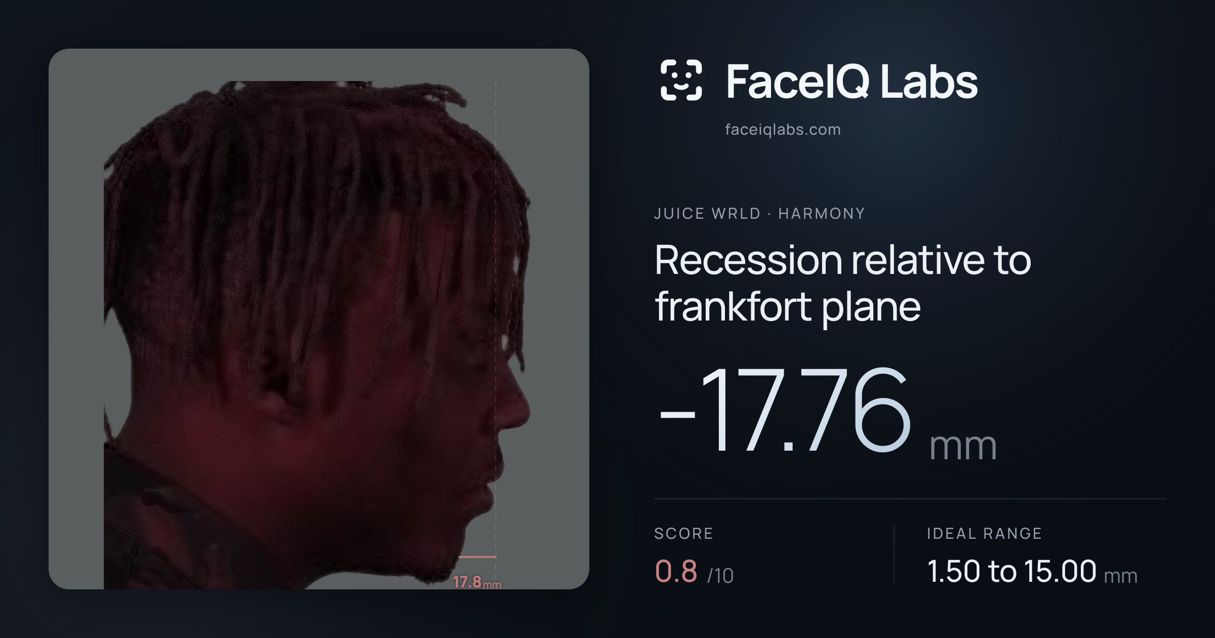 Juice WRLD Recession relative to frankfort plane: -17.76mm, drawn on the photo