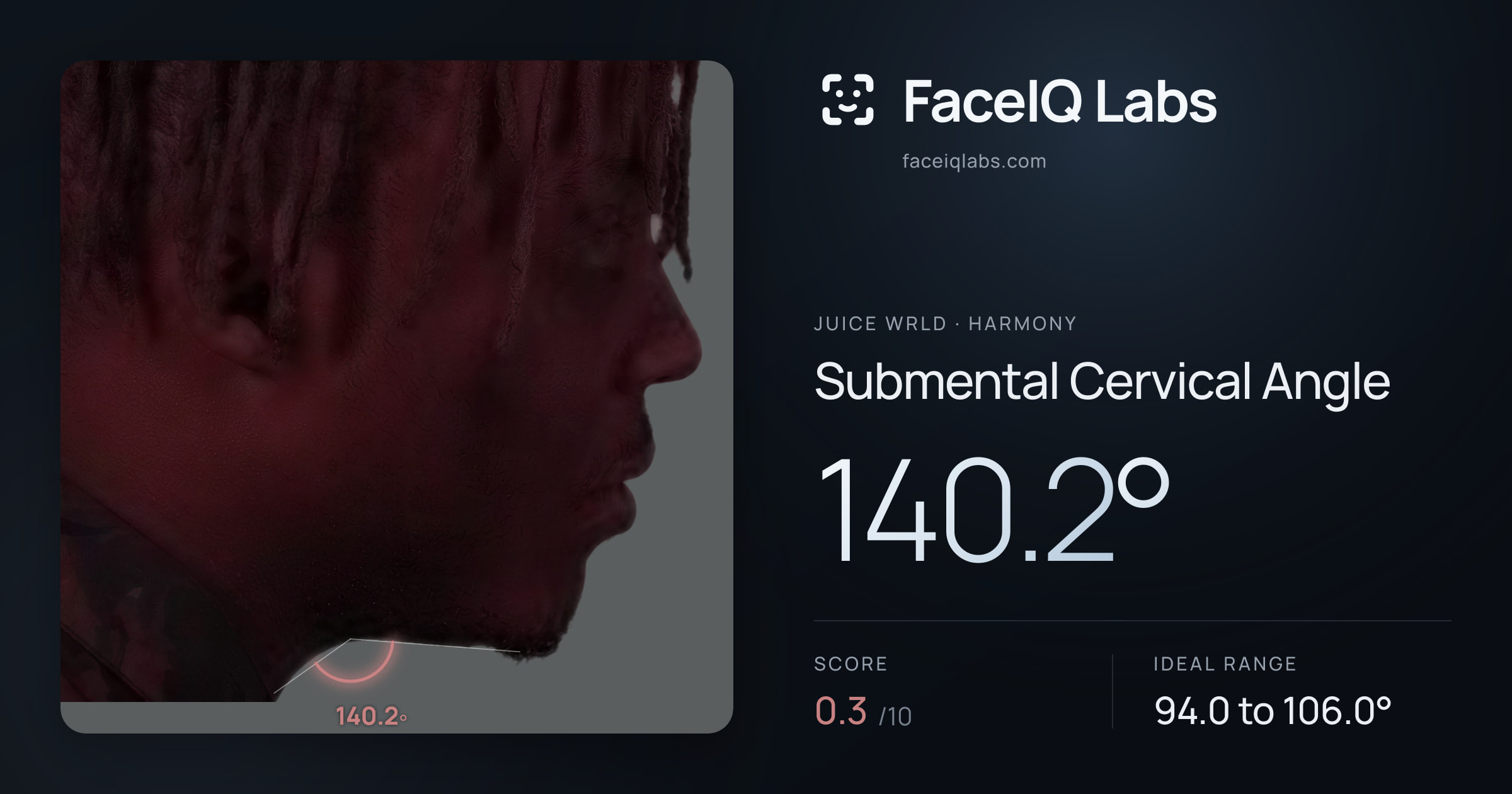 Juice WRLD Submental Cervical Angle: 140.2°, drawn on the photo