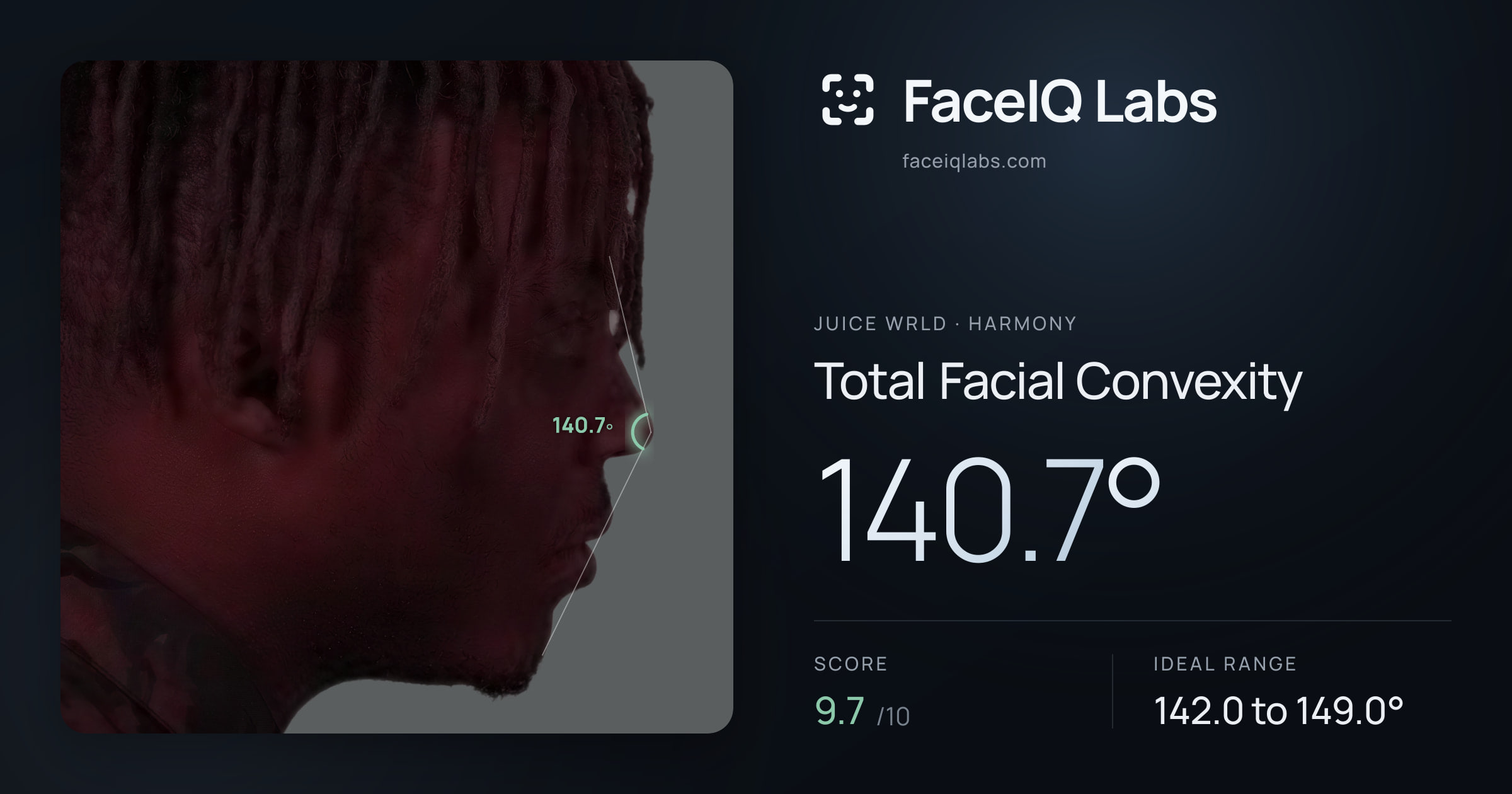 Juice WRLD Total Facial Convexity: 140.7°, drawn on the photo