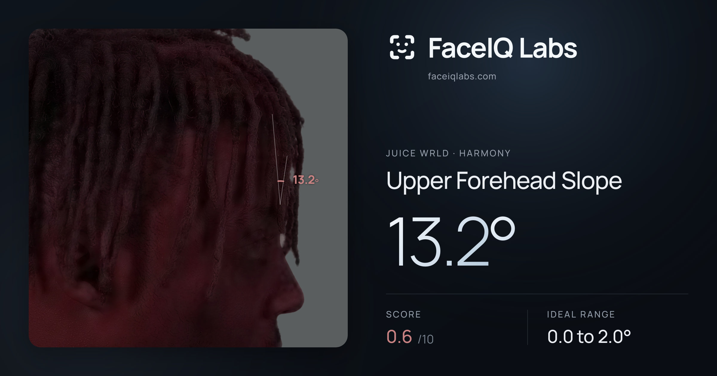 Juice WRLD Upper Forehead Slope: 13.2°, drawn on the photo