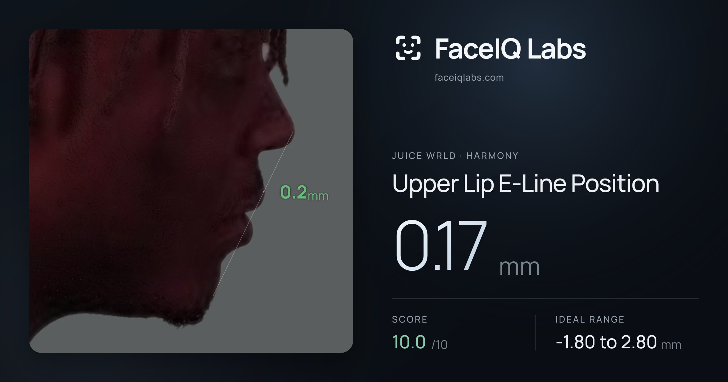 Juice WRLD Upper Lip E-Line Position: 0.17mm, drawn on the photo