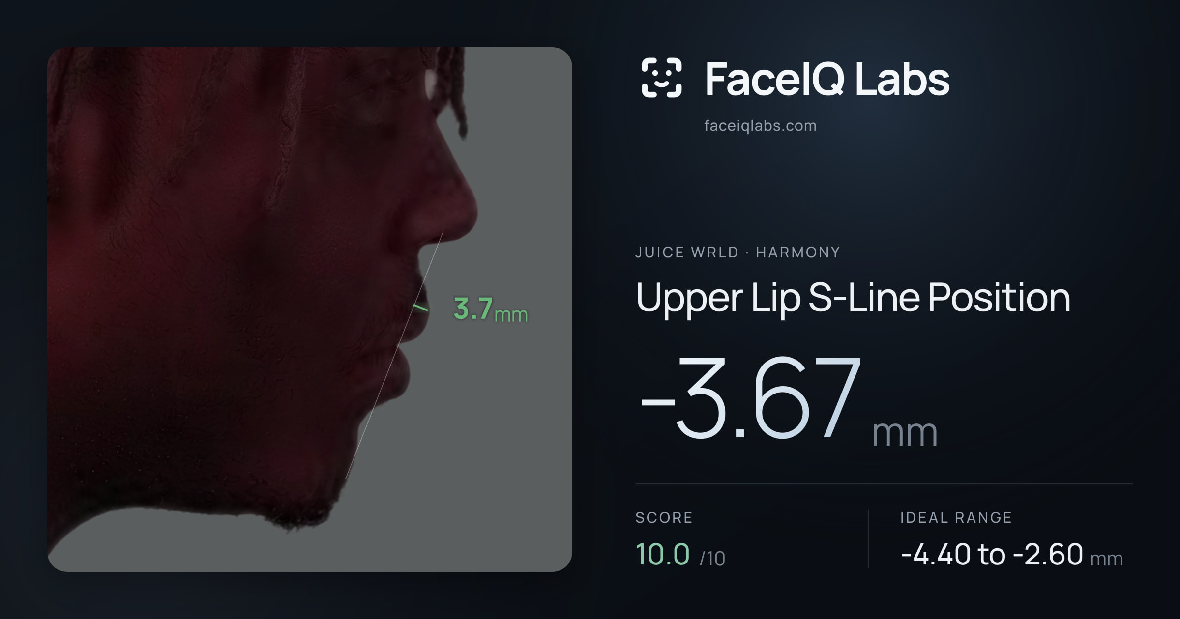 Juice WRLD Upper Lip S-Line Position: -3.67mm, drawn on the photo