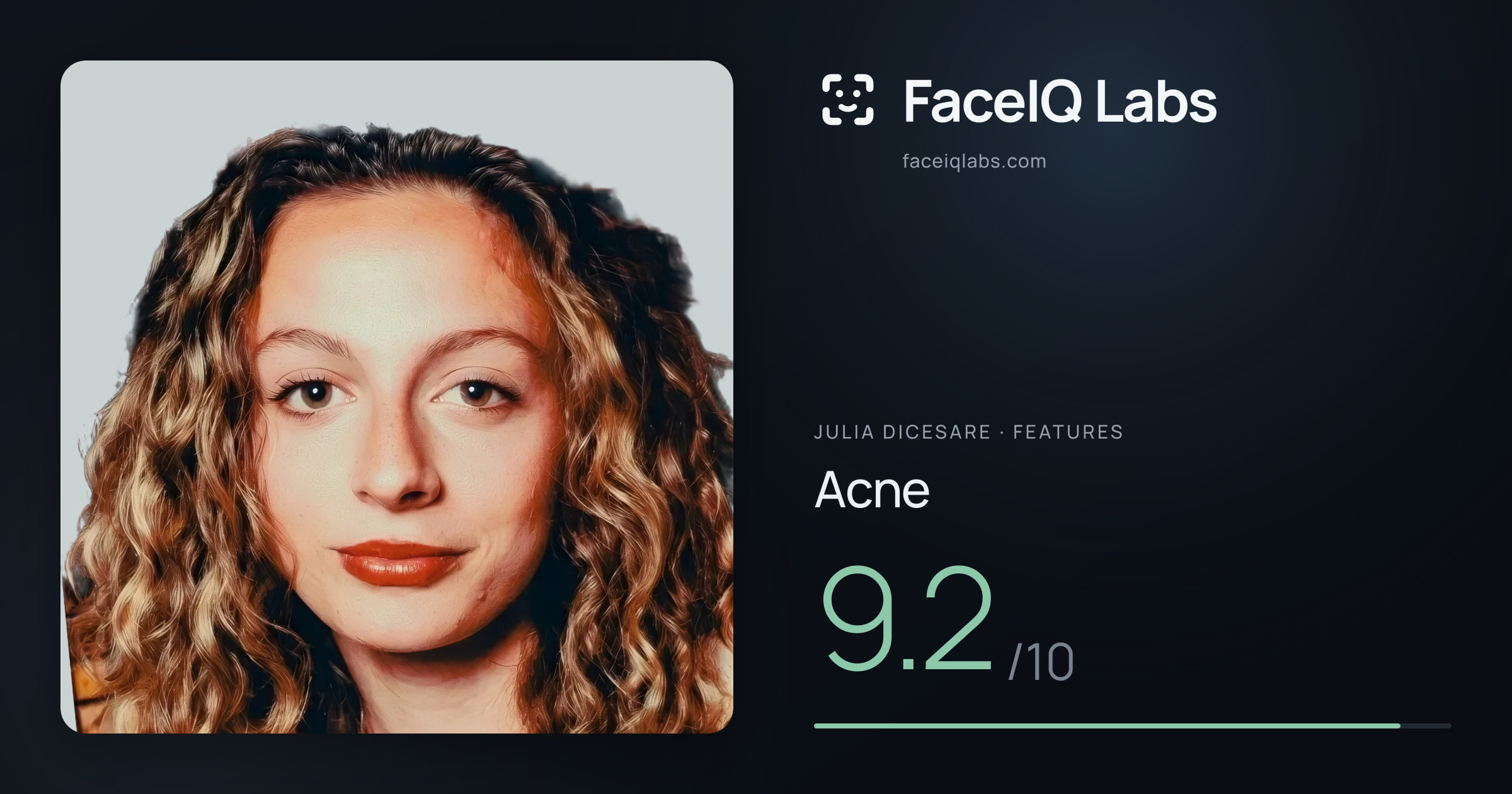 Julia DiCesare Acne: 9.2/10, drawn on the photo