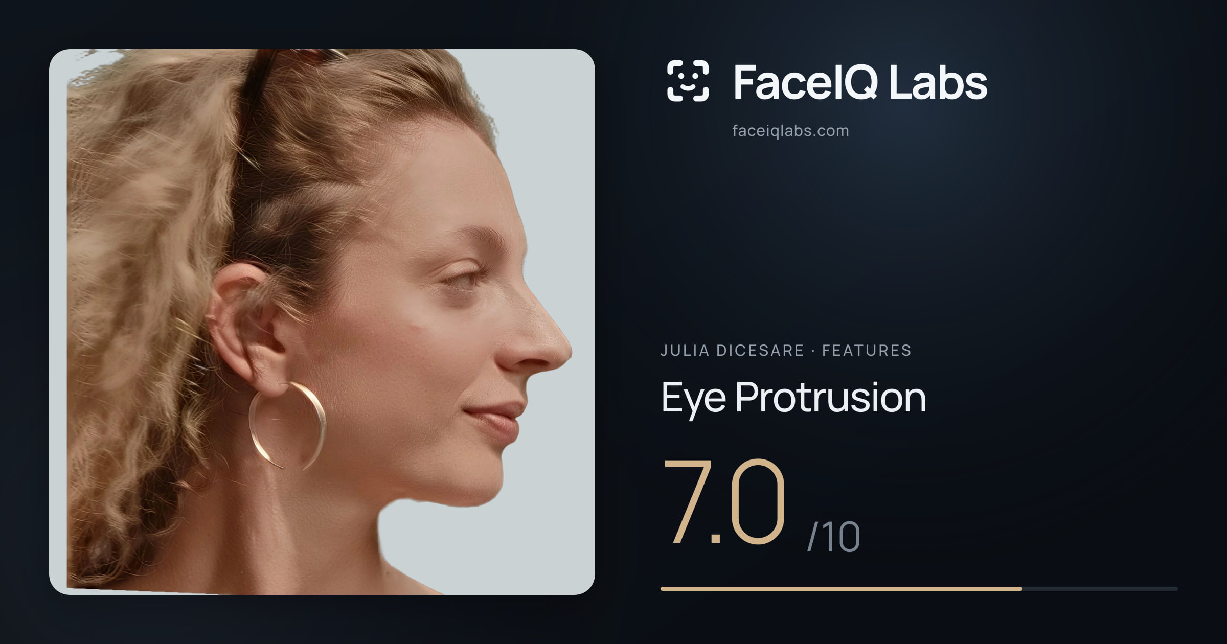 Julia DiCesare Eye Protrusion: 7.0/10, drawn on the photo