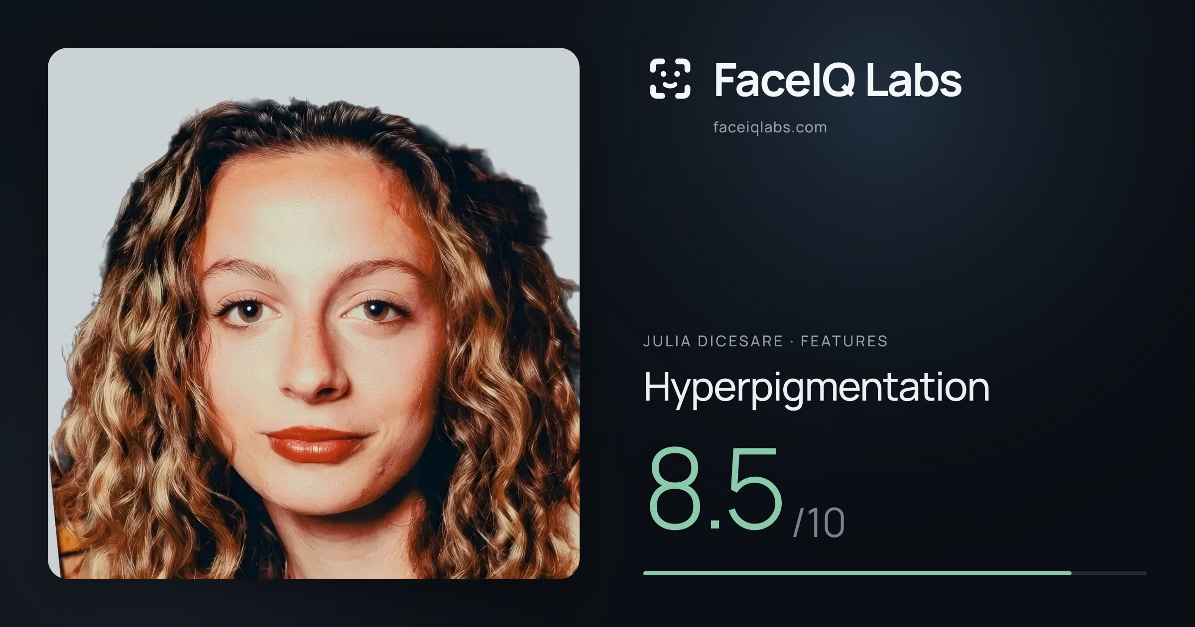 Julia DiCesare Hyperpigmentation: 8.5/10, drawn on the photo