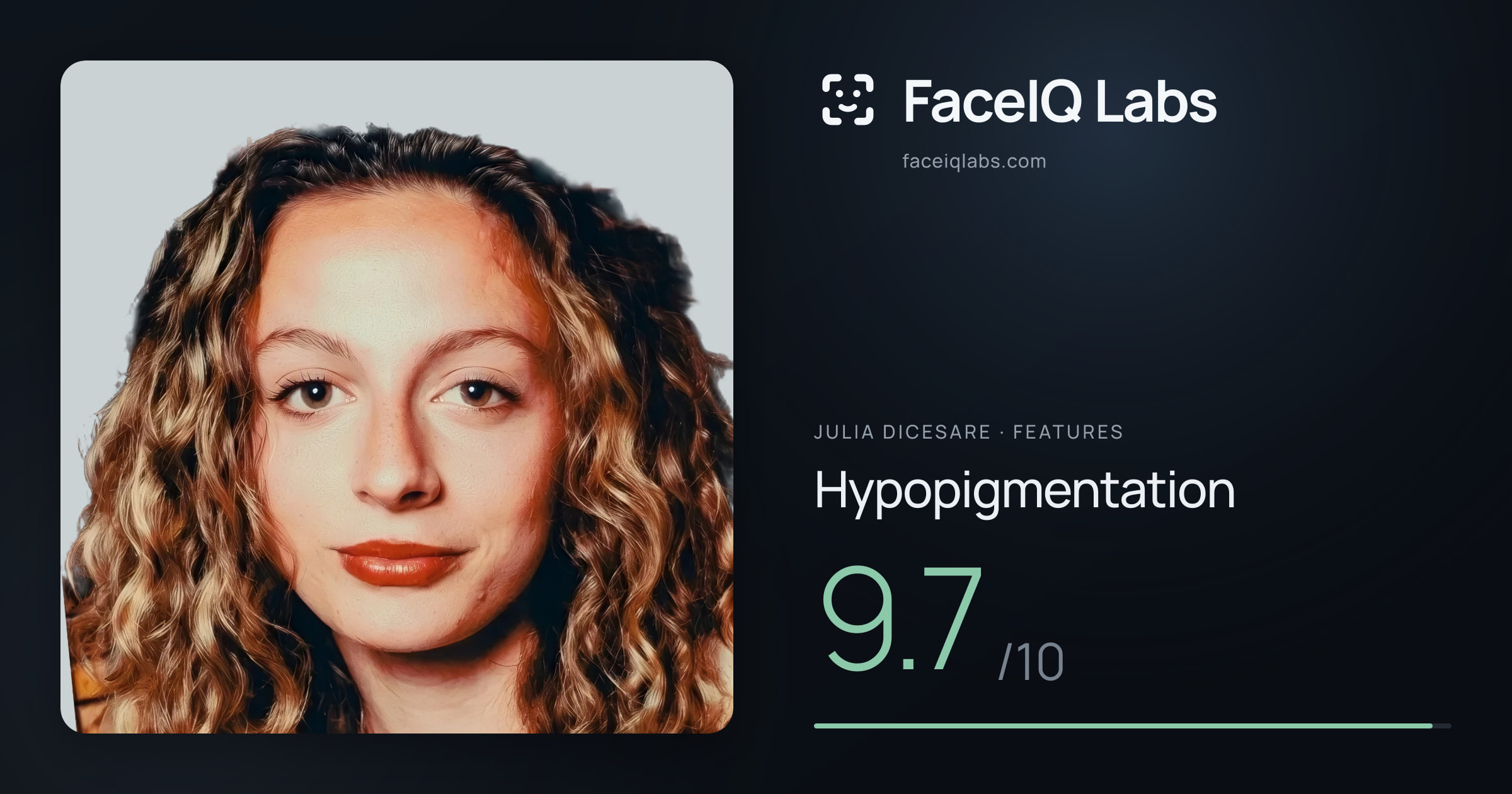 Julia DiCesare Hypopigmentation: 9.7/10, drawn on the photo