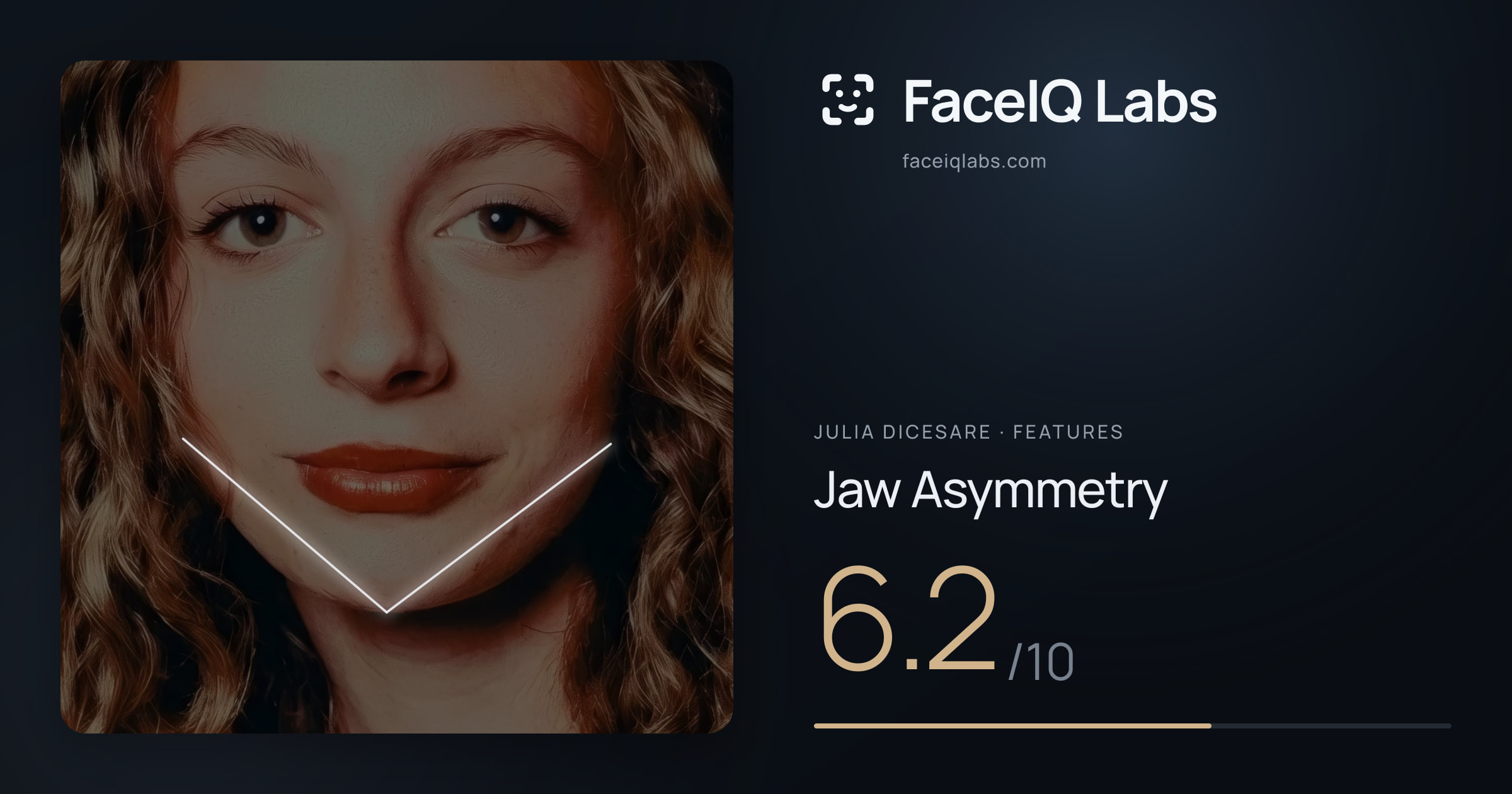 Julia DiCesare Jaw Asymmetry: 6.2/10, drawn on the photo