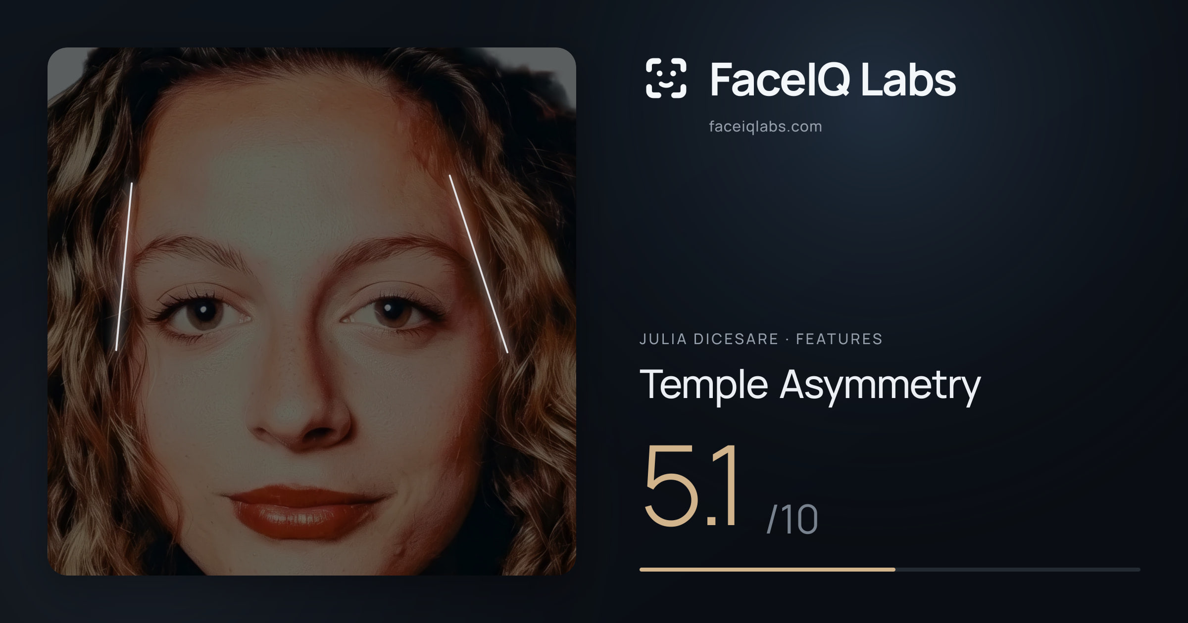Julia DiCesare Temple Asymmetry: 5.1/10, drawn on the photo