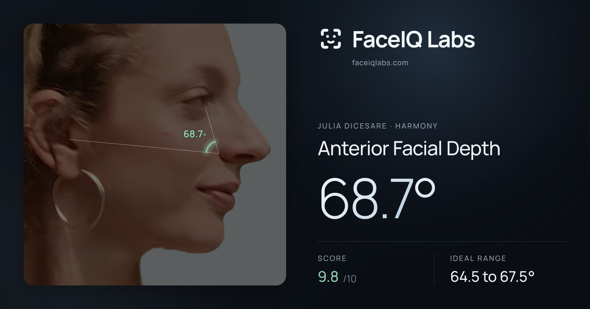 Julia DiCesare Anterior Facial Depth: 68.7°, drawn on the photo