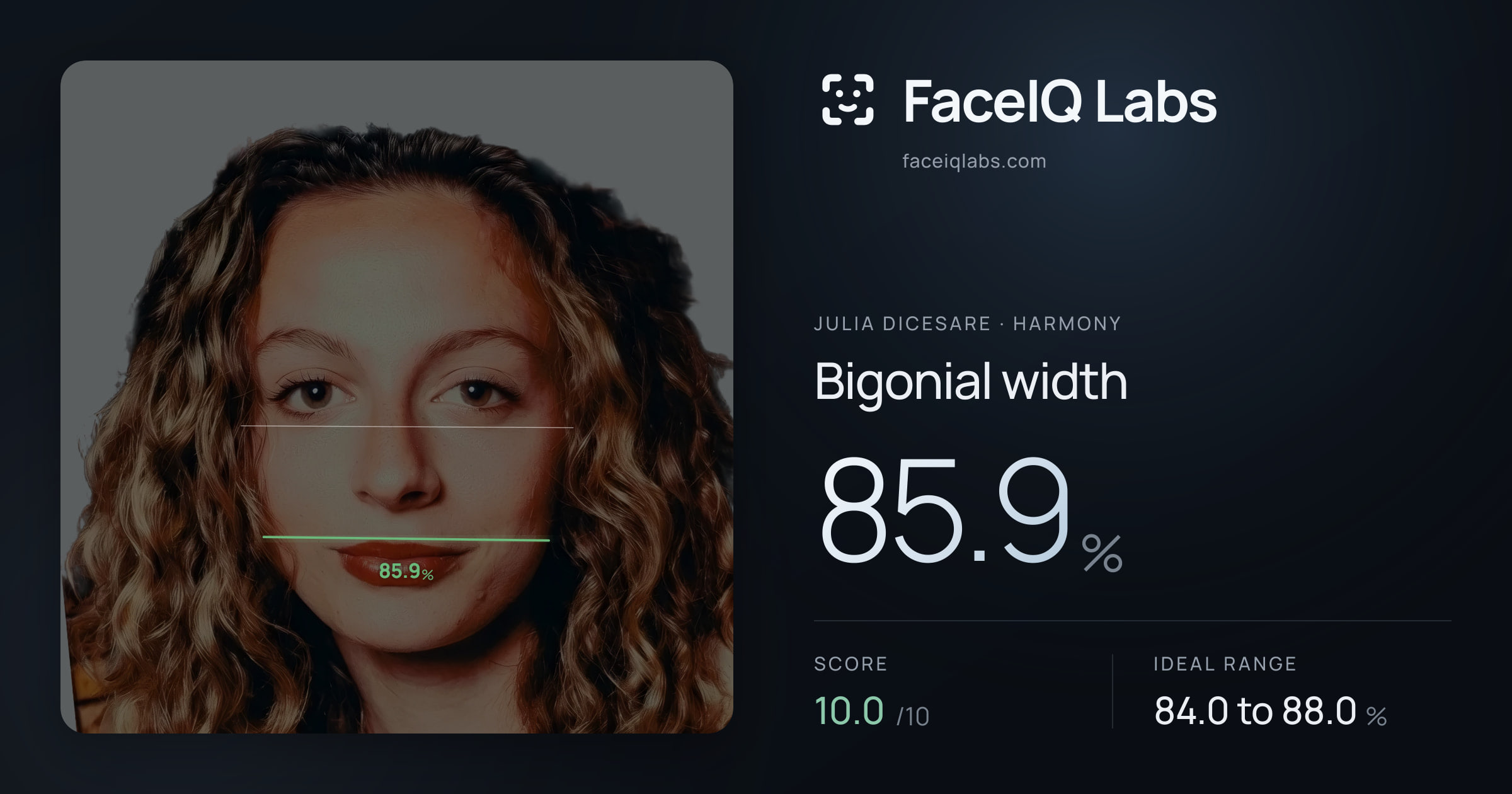 Julia DiCesare Bigonial width: 85.9%, drawn on the photo