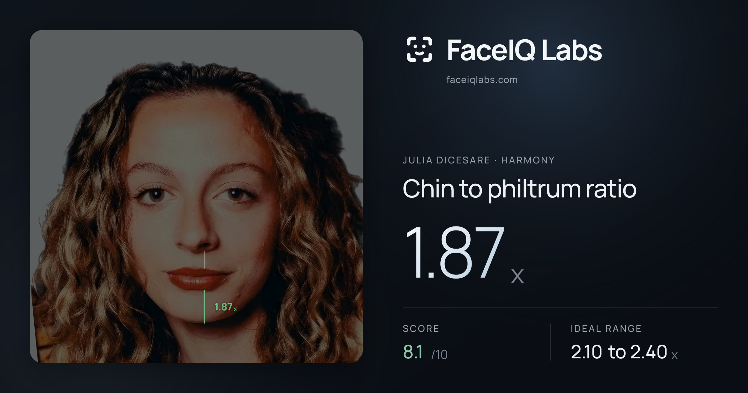 Julia DiCesare Chin to philtrum ratio: 1.87x, drawn on the photo
