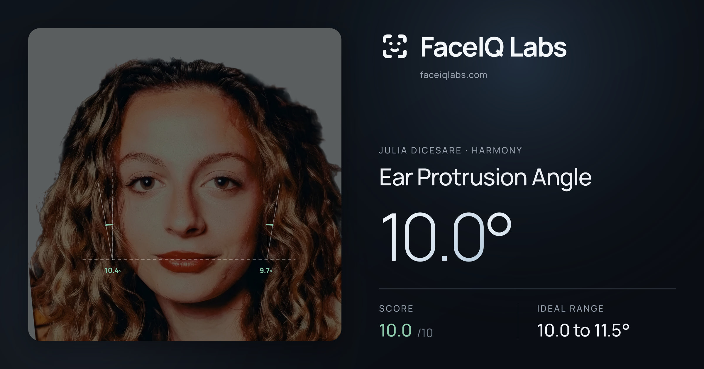 Julia DiCesare Ear Protrusion Angle: 10.0°, drawn on the photo