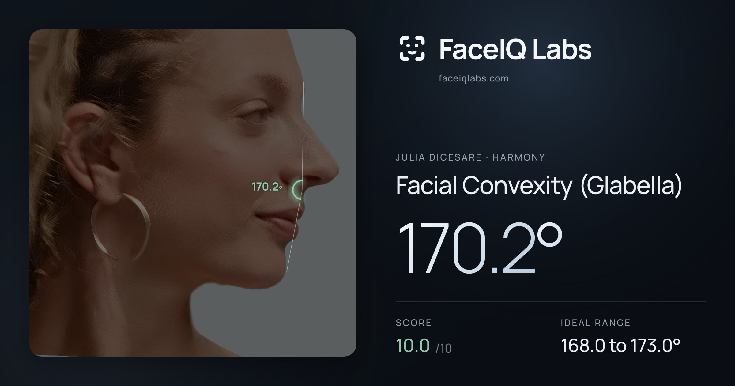 Julia DiCesare Facial Convexity (Glabella): 170.2°, drawn on the photo