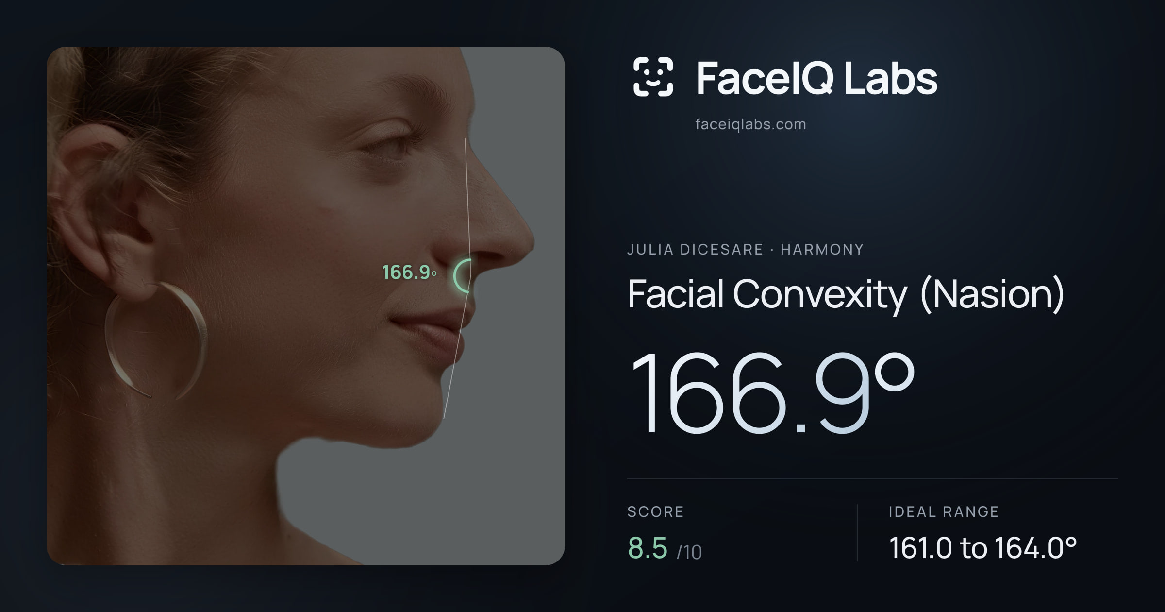 Julia DiCesare Facial Convexity (Nasion): 166.9°, drawn on the photo