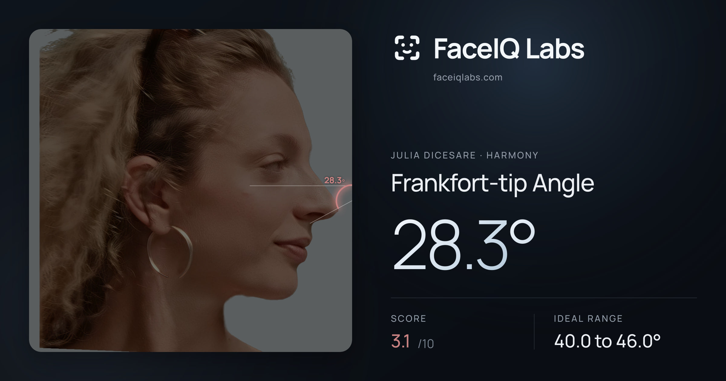 Julia DiCesare Frankfort-tip Angle: 28.3°, drawn on the photo