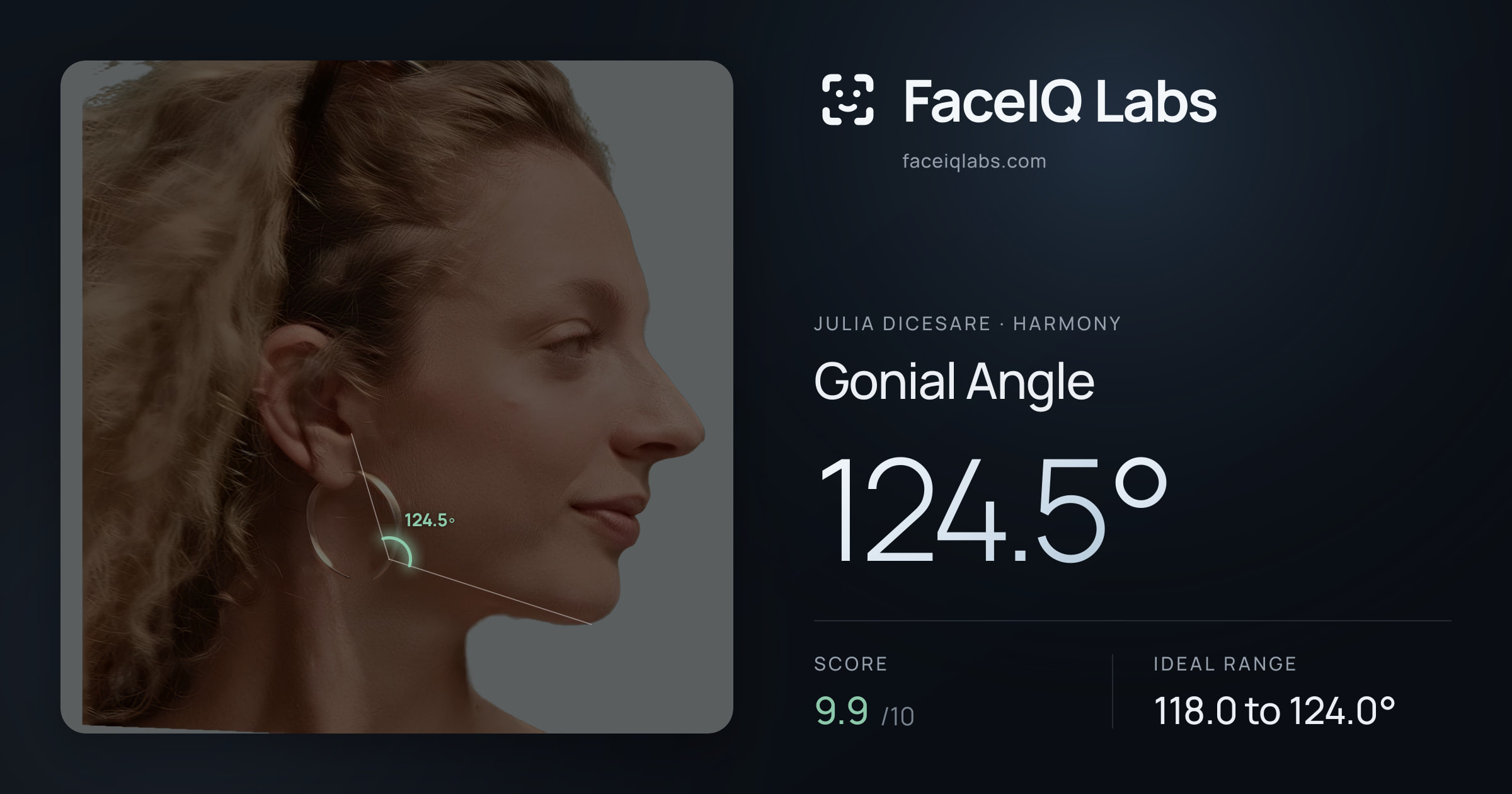 Julia DiCesare Gonial Angle: 124.5°, drawn on the photo
