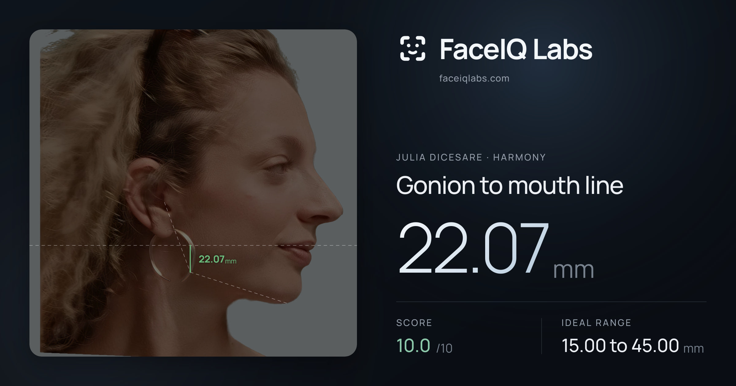 Julia DiCesare Gonion to mouth line: 22.07mm, drawn on the photo