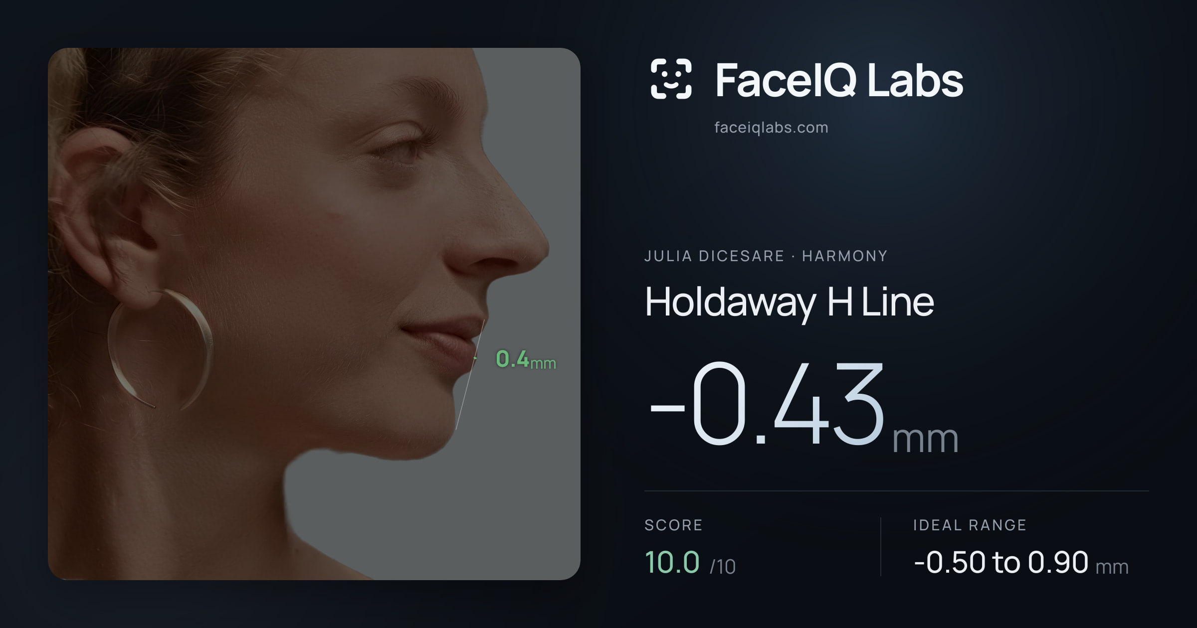 Julia DiCesare Holdaway H Line: -0.43mm, drawn on the photo
