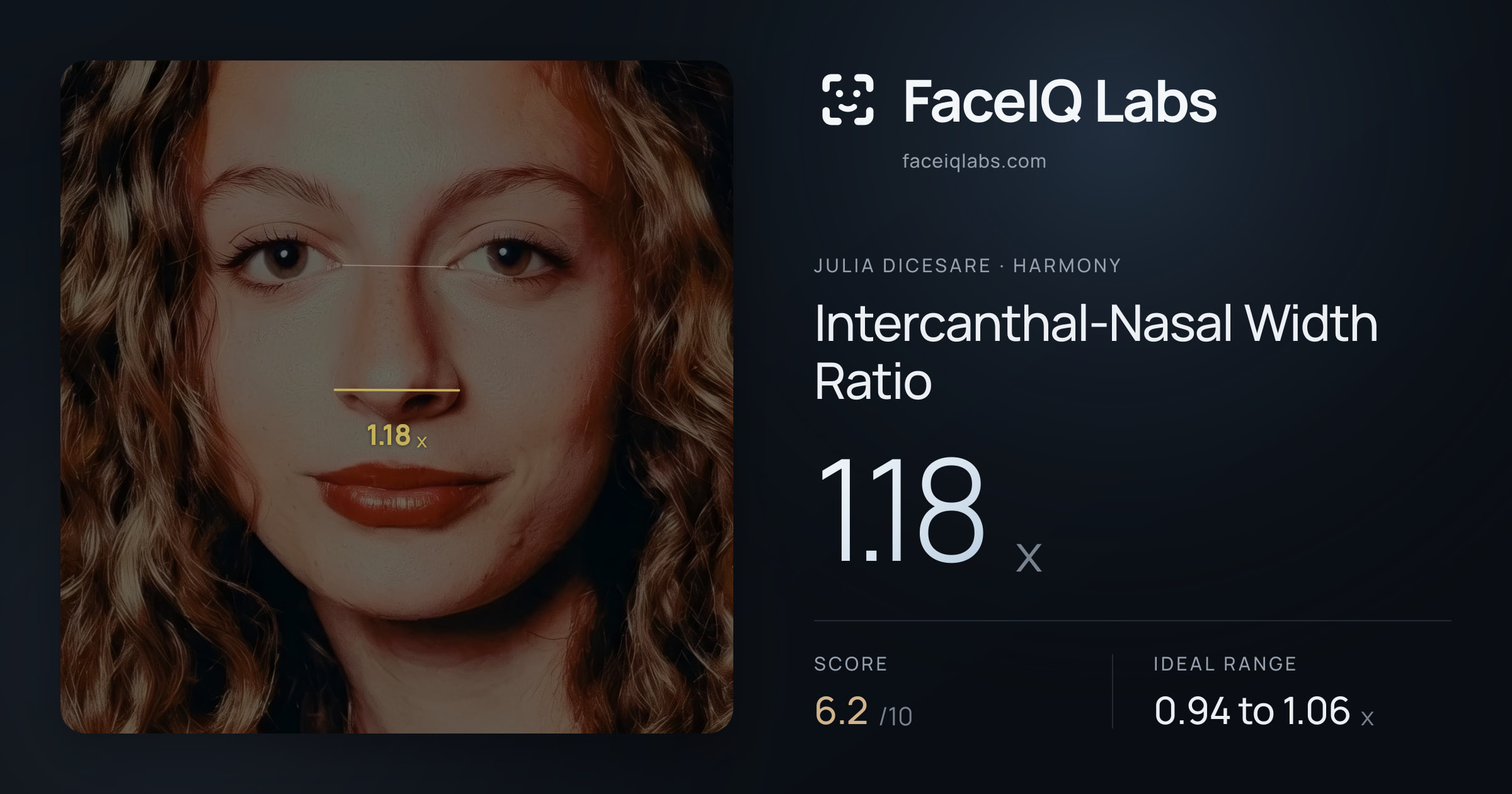 Julia DiCesare Intercanthal-Nasal Width Ratio: 1.18x, drawn on the photo