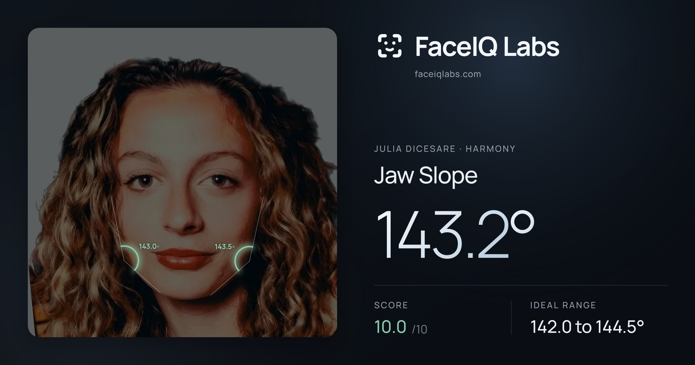 Julia DiCesare Jaw Slope: 143.2°, drawn on the photo
