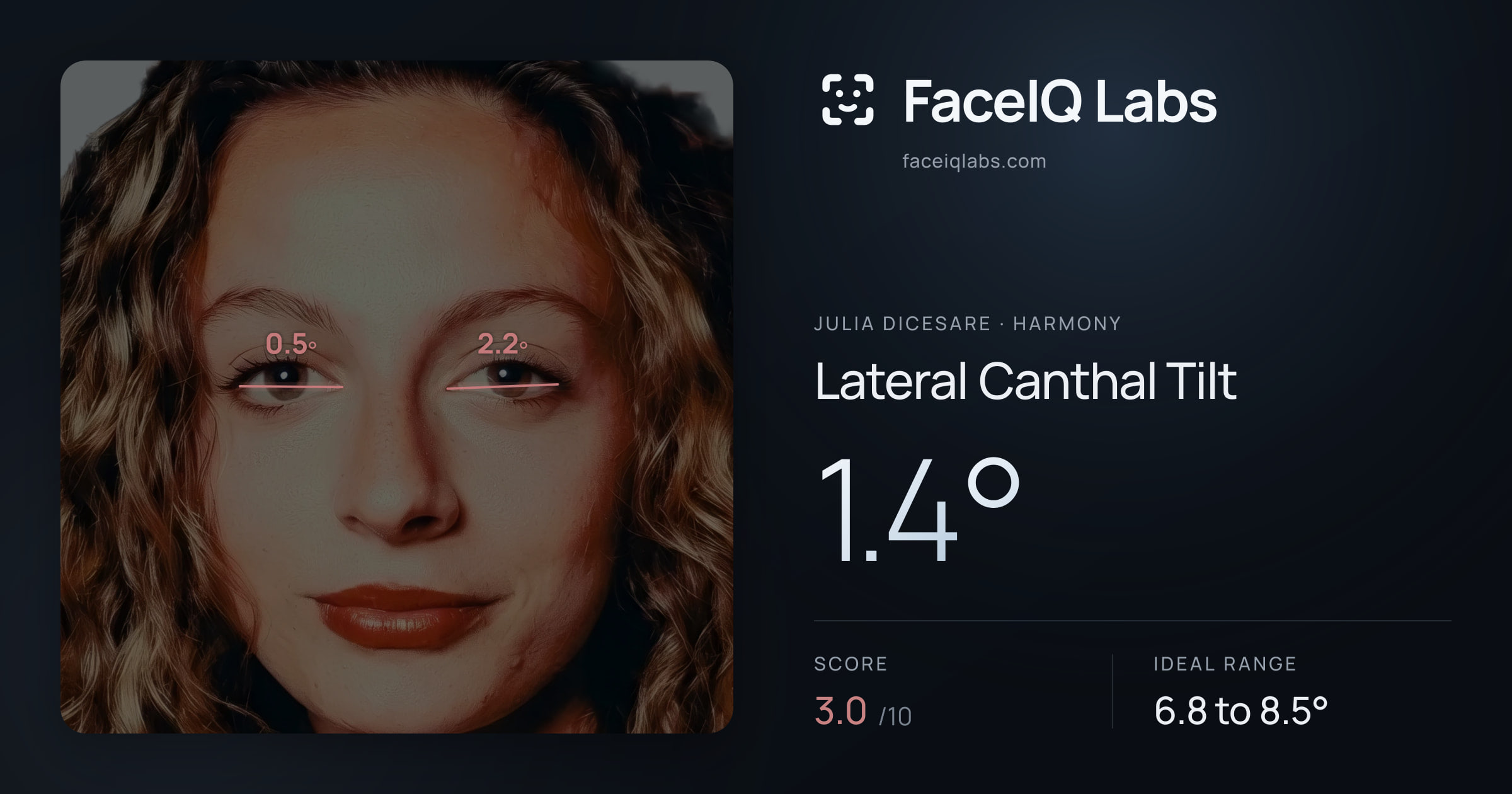 Julia DiCesare Lateral Canthal Tilt: 1.4°, drawn on the photo