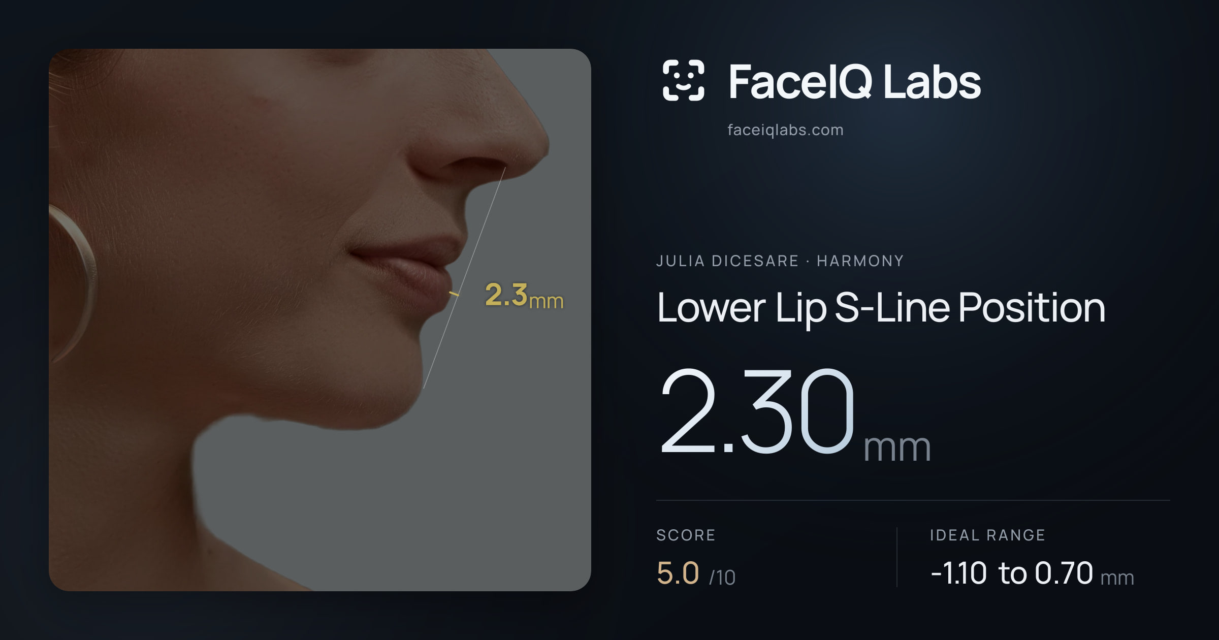 Julia DiCesare Lower Lip S-Line Position: 2.30mm, drawn on the photo