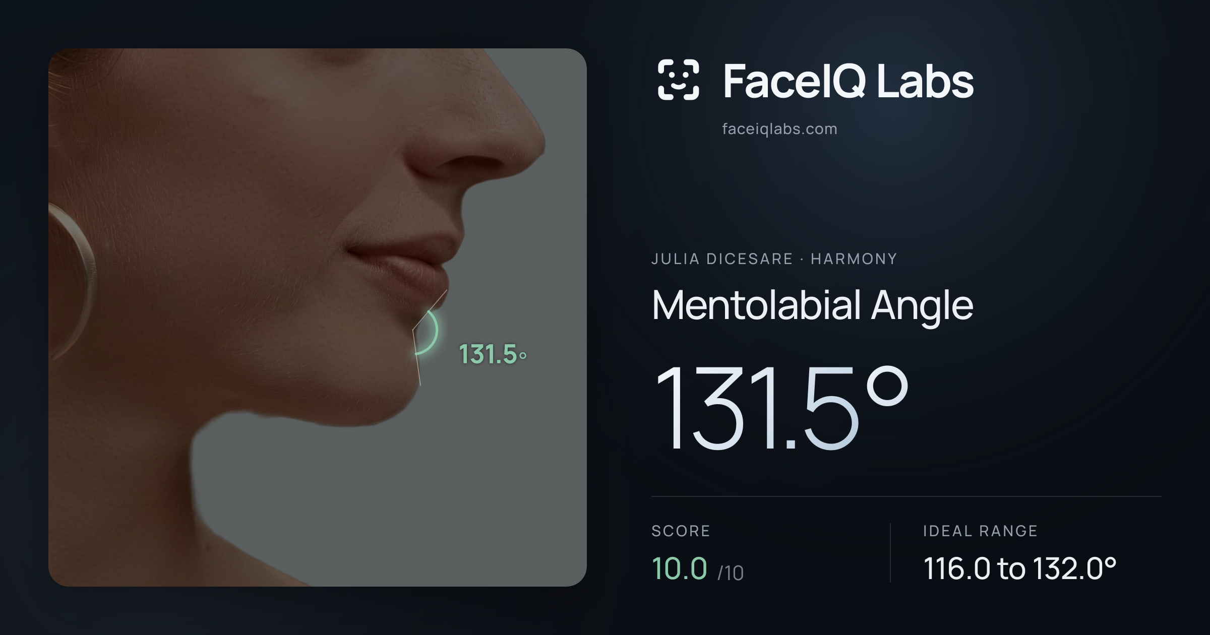 Julia DiCesare Mentolabial Angle: 131.5°, drawn on the photo