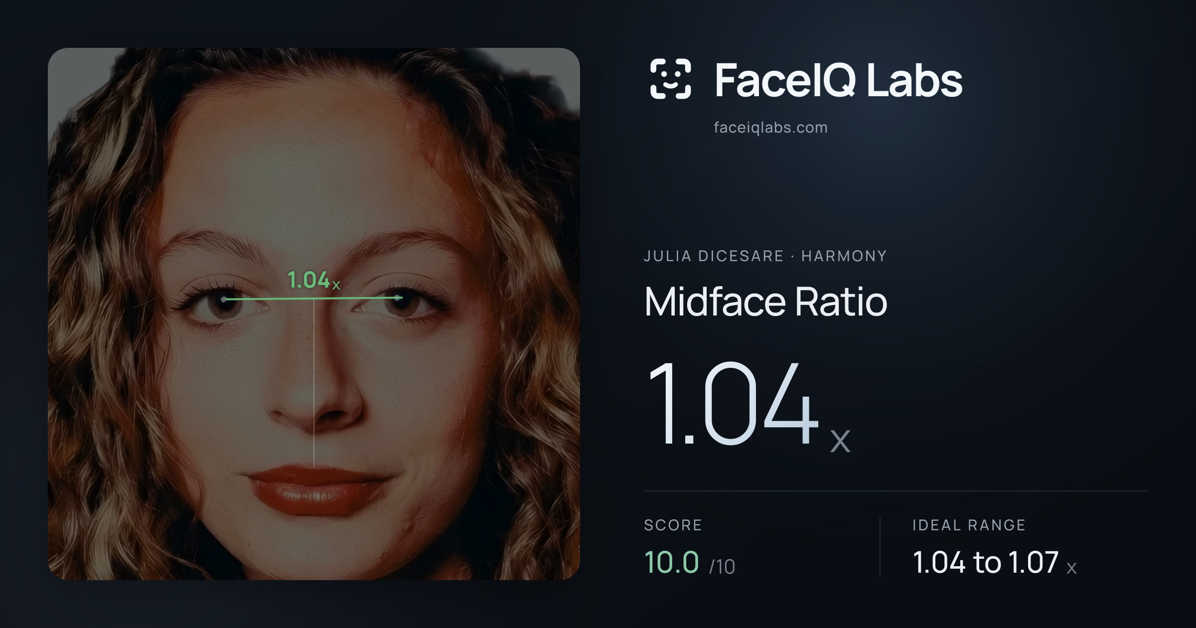 Julia DiCesare Midface Ratio: 1.04x, drawn on the photo