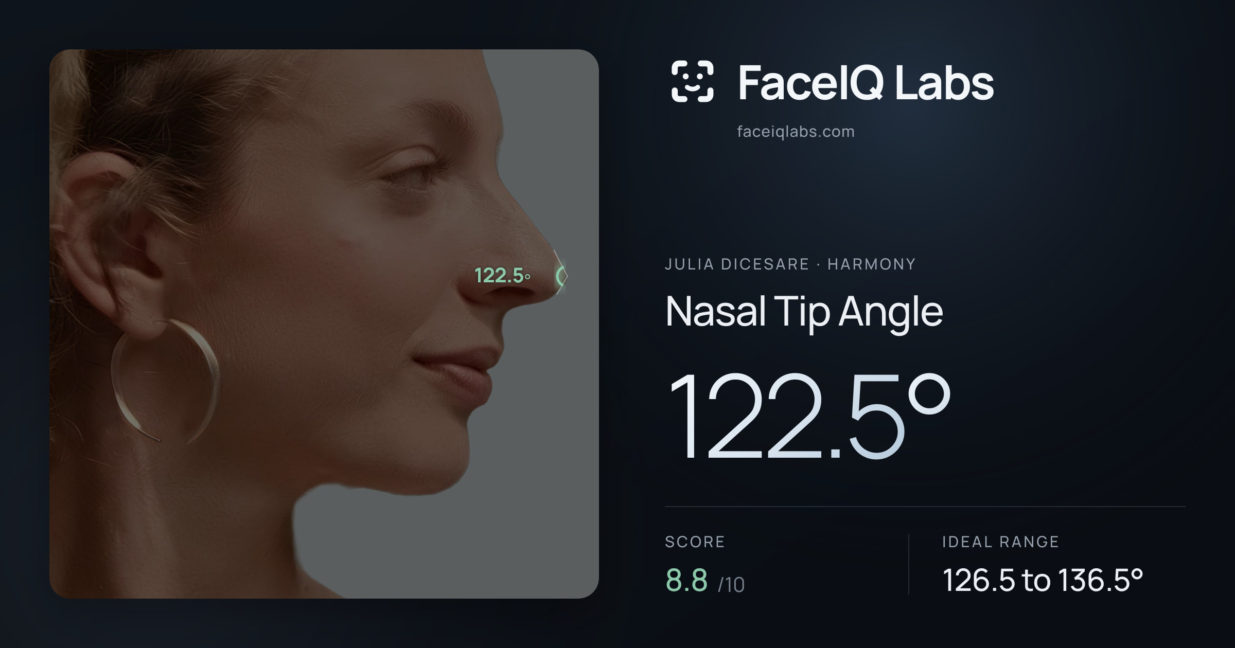 Julia DiCesare Nasal Tip Angle: 122.5°, drawn on the photo