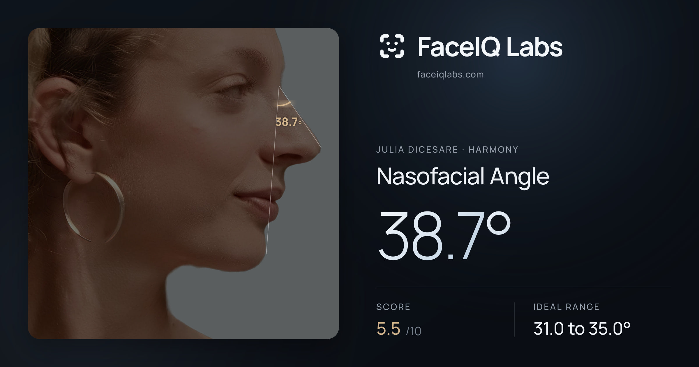 Julia DiCesare Nasofacial Angle: 38.7°, drawn on the photo