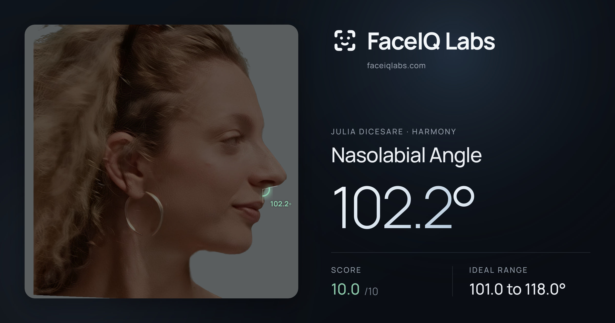 Julia DiCesare Nasolabial Angle: 102.2°, drawn on the photo