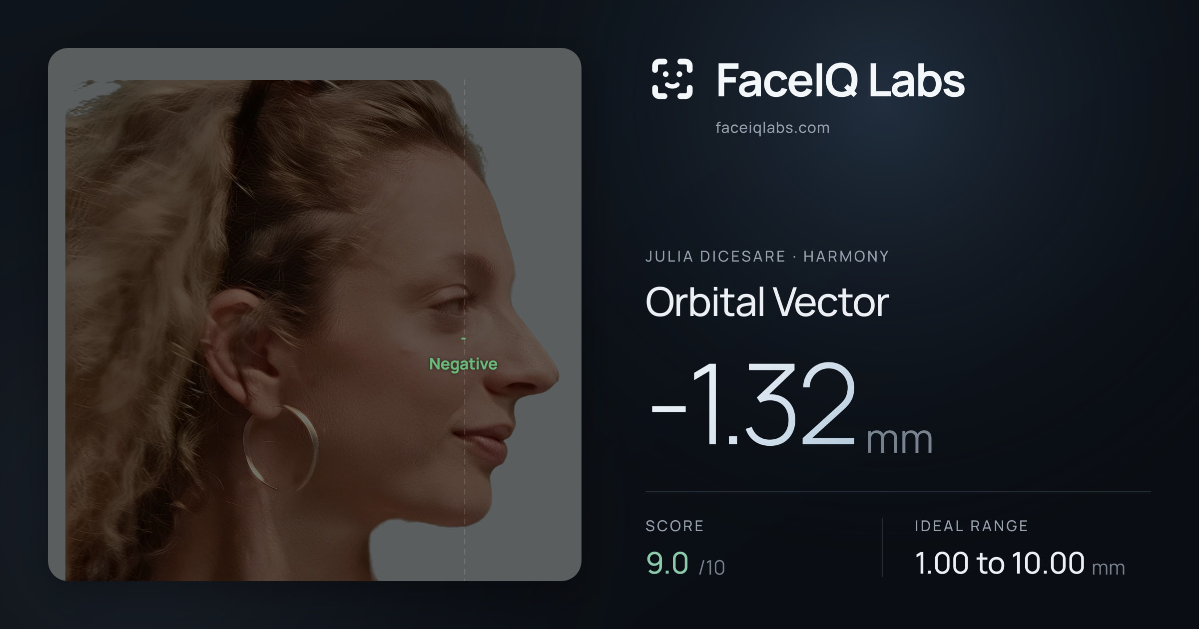 Julia DiCesare Orbital Vector: -1.32mm, drawn on the photo