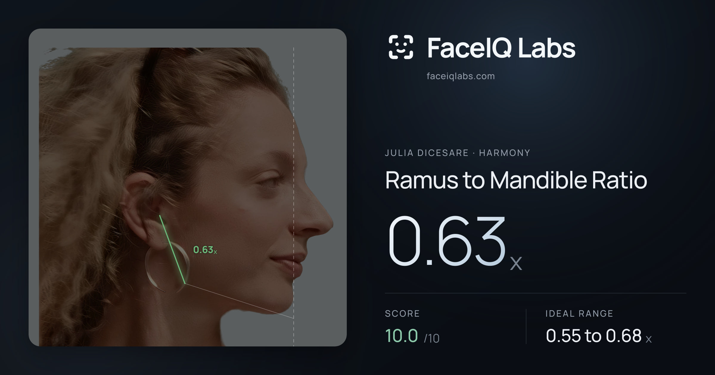 Julia DiCesare Ramus to Mandible Ratio: 0.63x, drawn on the photo