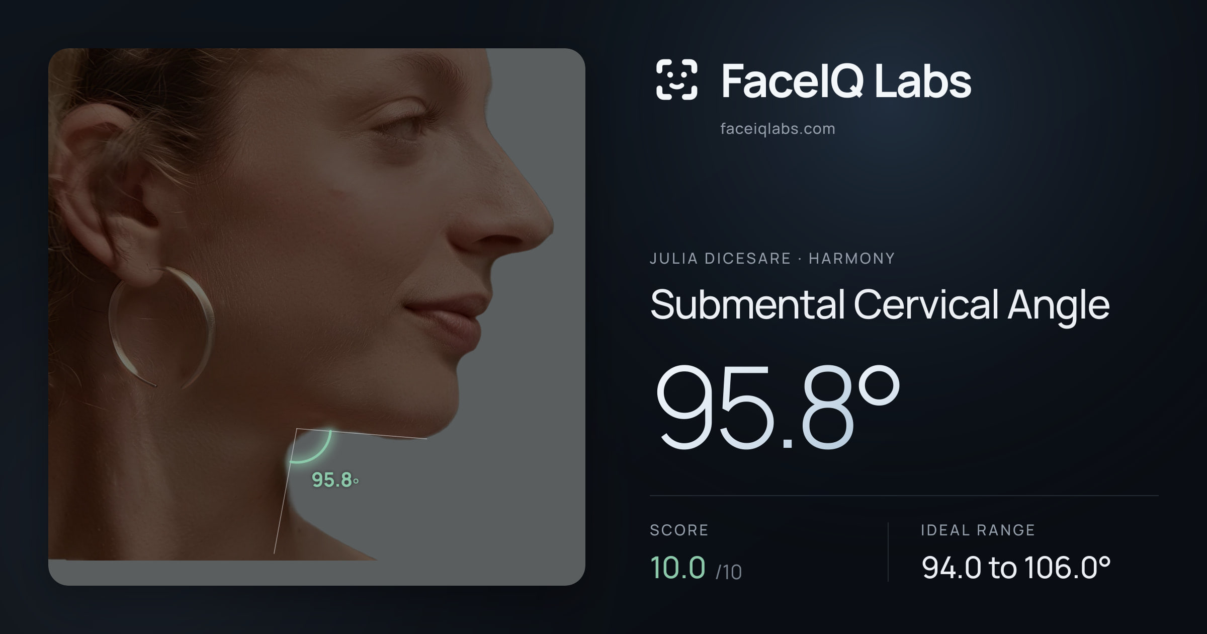 Julia DiCesare Submental Cervical Angle: 95.8°, drawn on the photo