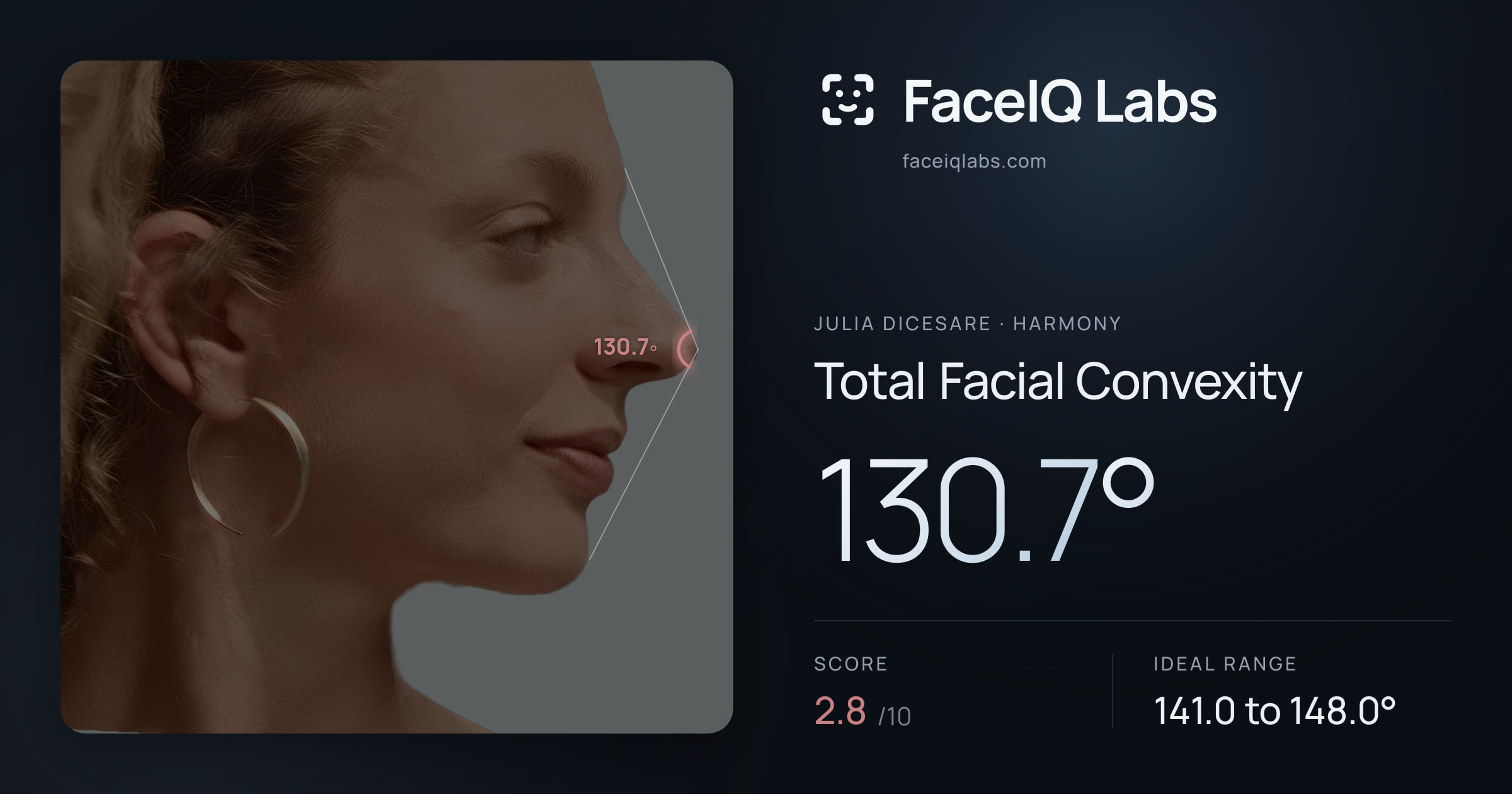 Julia DiCesare Total Facial Convexity: 130.7°, drawn on the photo