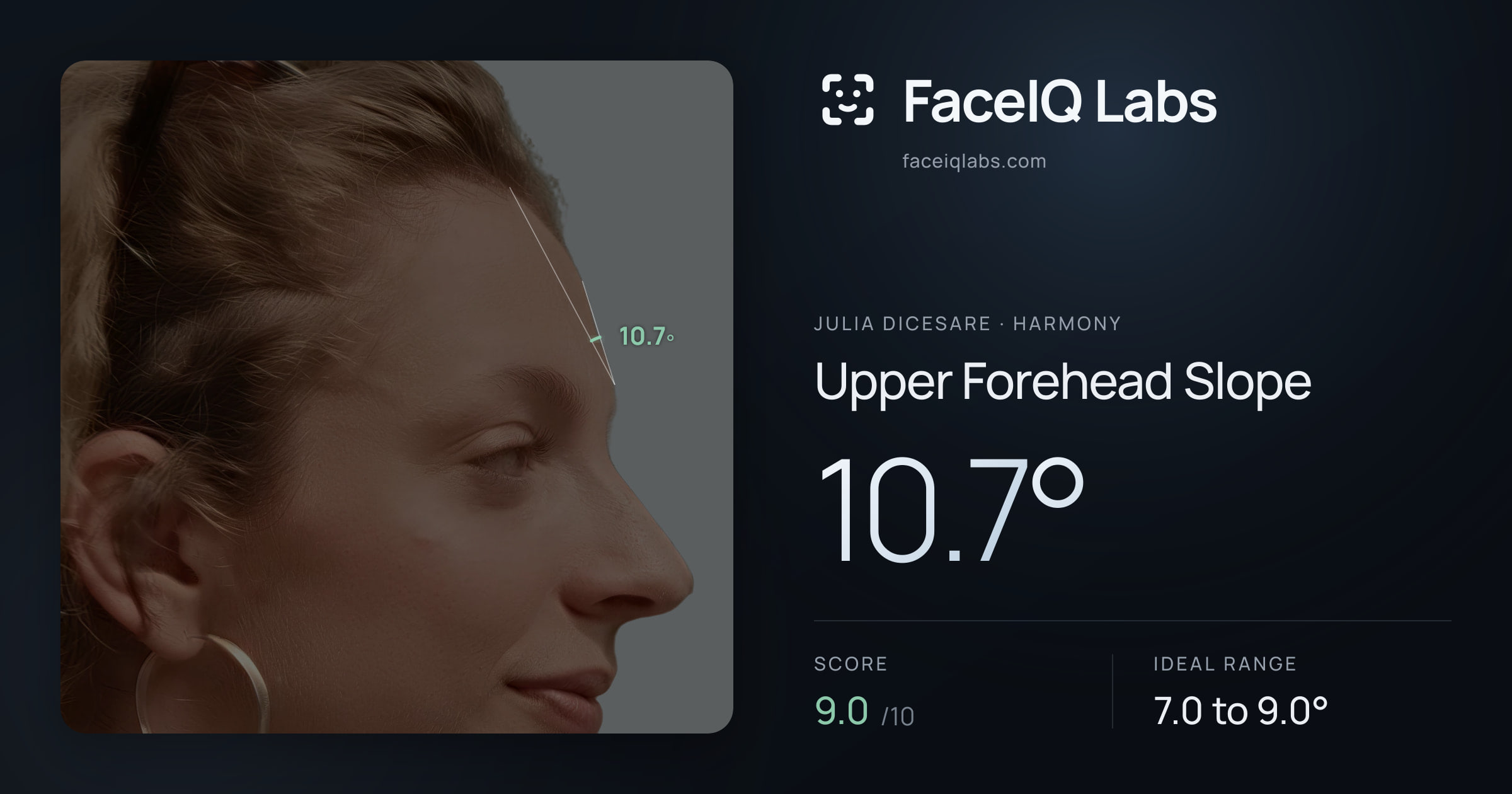 Julia DiCesare Upper Forehead Slope: 10.7°, drawn on the photo