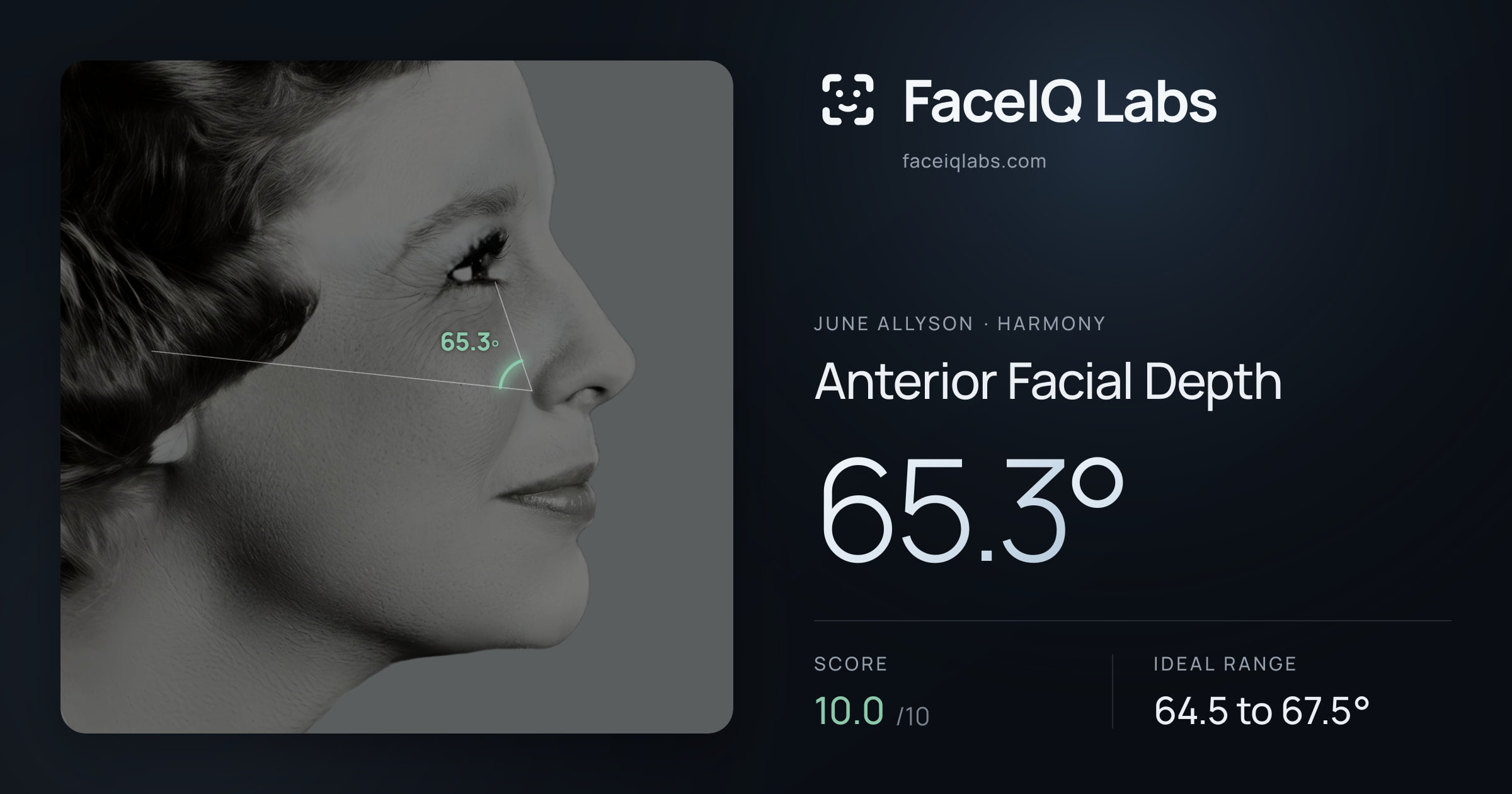 June Allyson Anterior Facial Depth: 65.3°, drawn on the photo