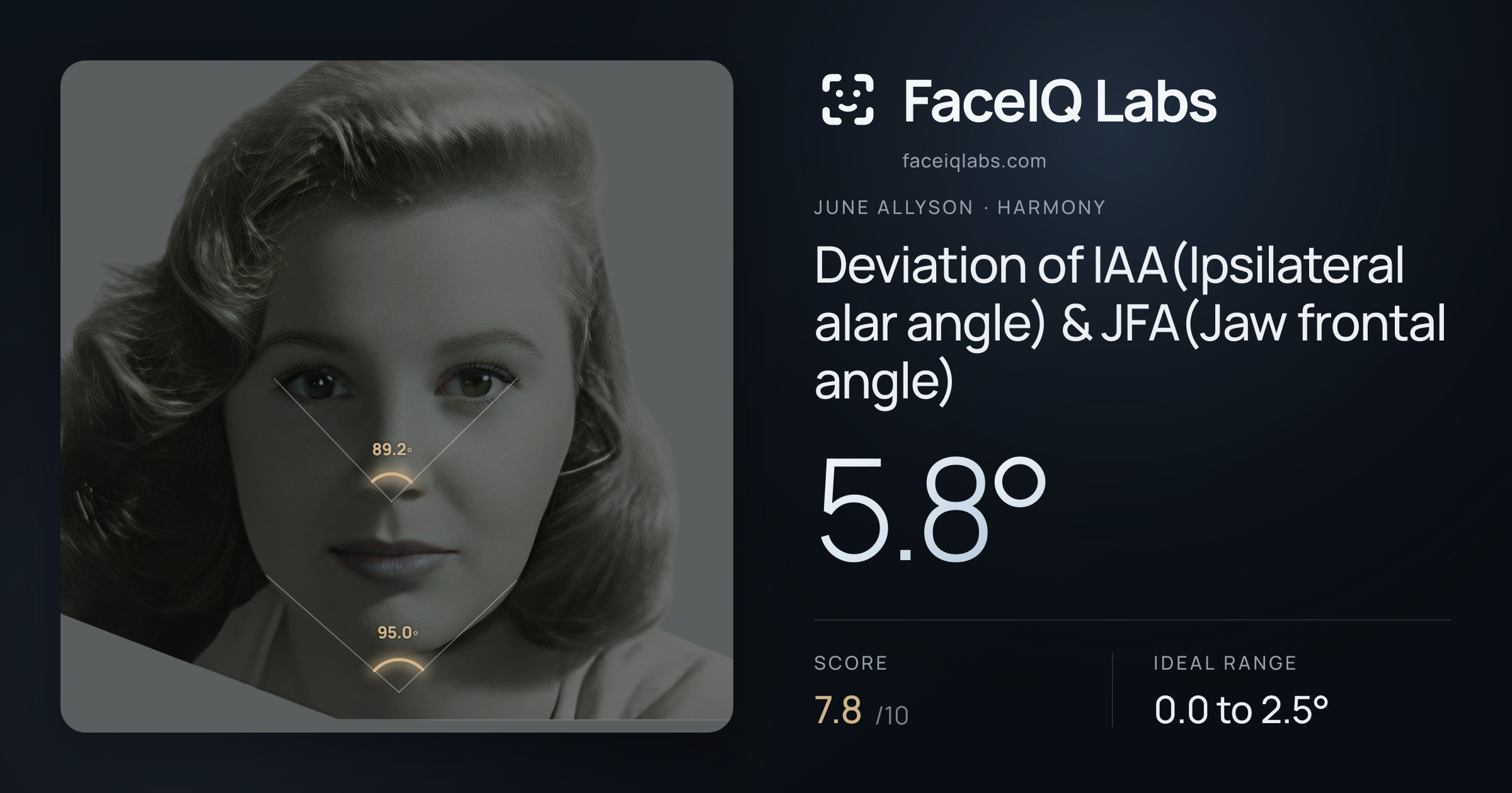 June Allyson Deviation of IAA(Ipsilateral alar angle) & JFA(Jaw frontal angle): 5.8°, drawn on the photo