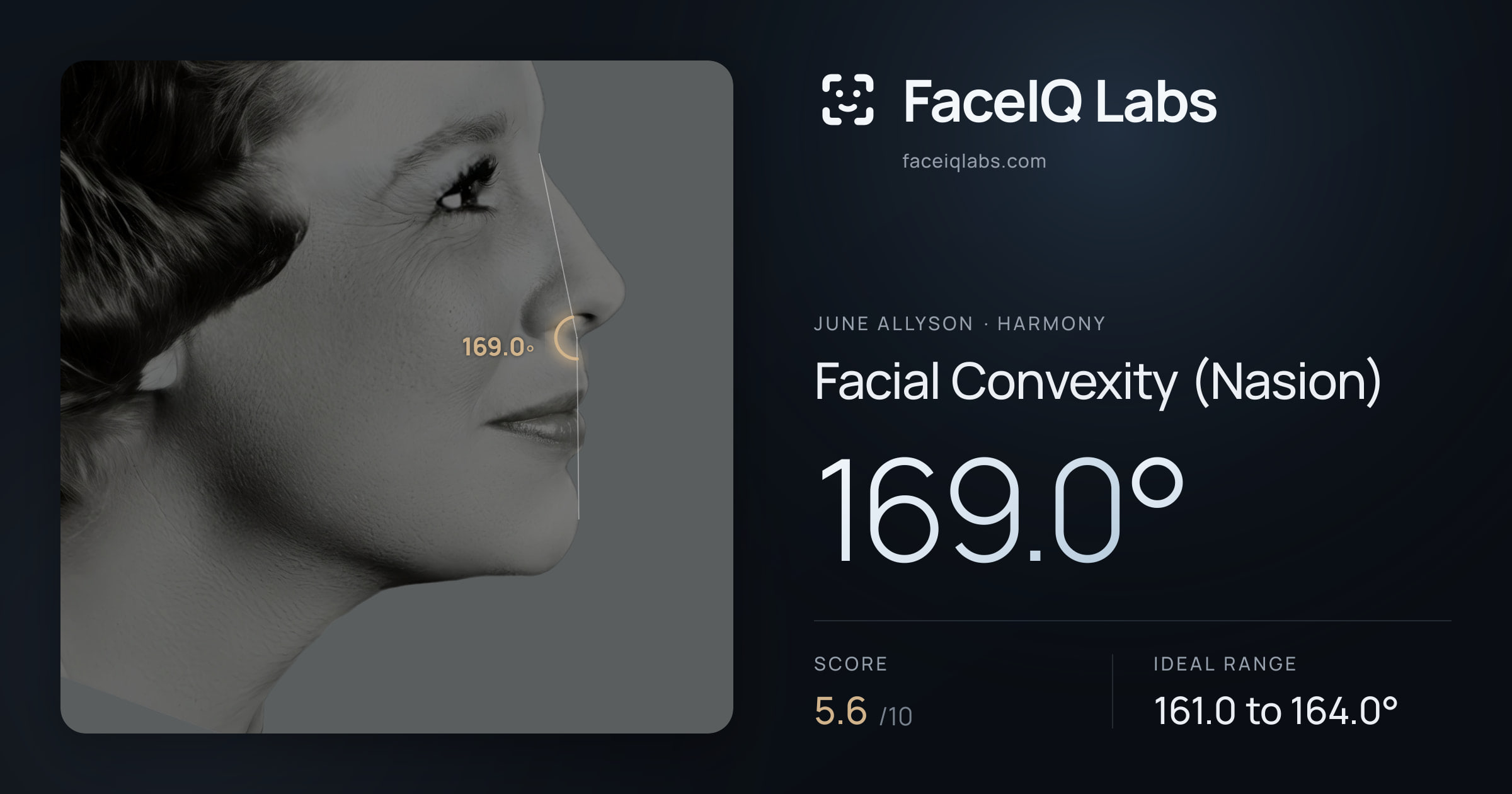 June Allyson Facial Convexity (Nasion): 169.0°, drawn on the photo