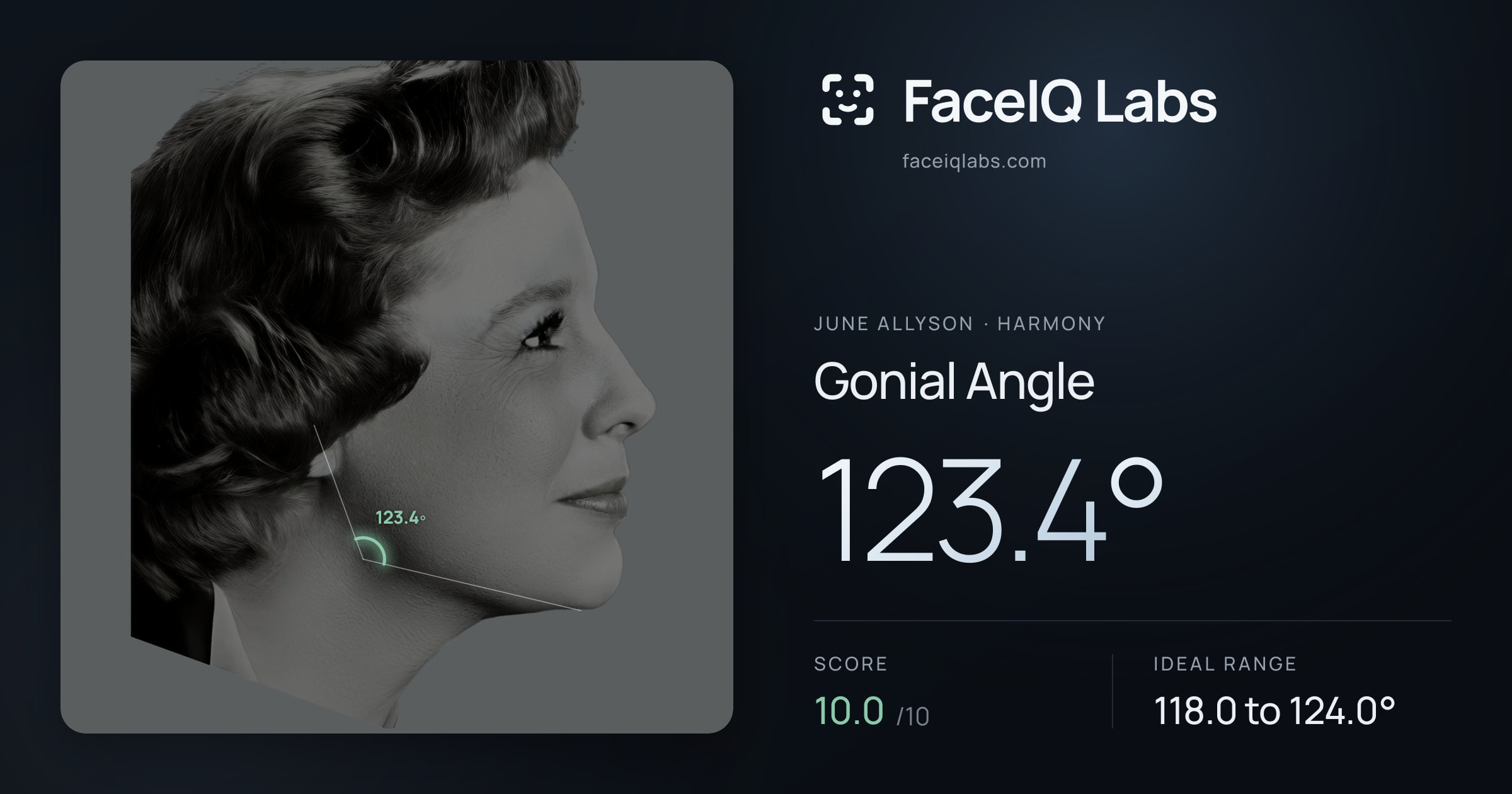 June Allyson Gonial Angle: 123.4°, drawn on the photo