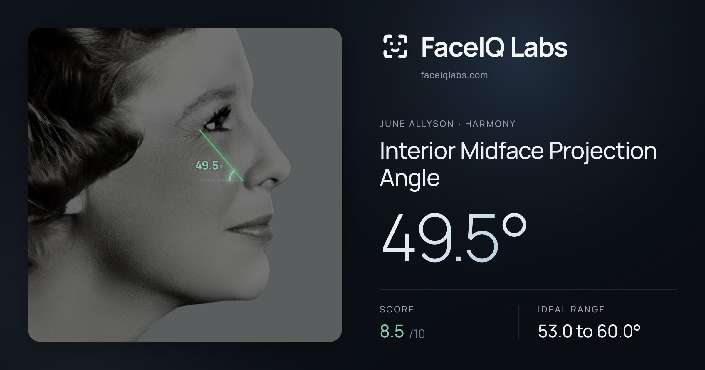 June Allyson Interior Midface Projection Angle: 49.5°, drawn on the photo